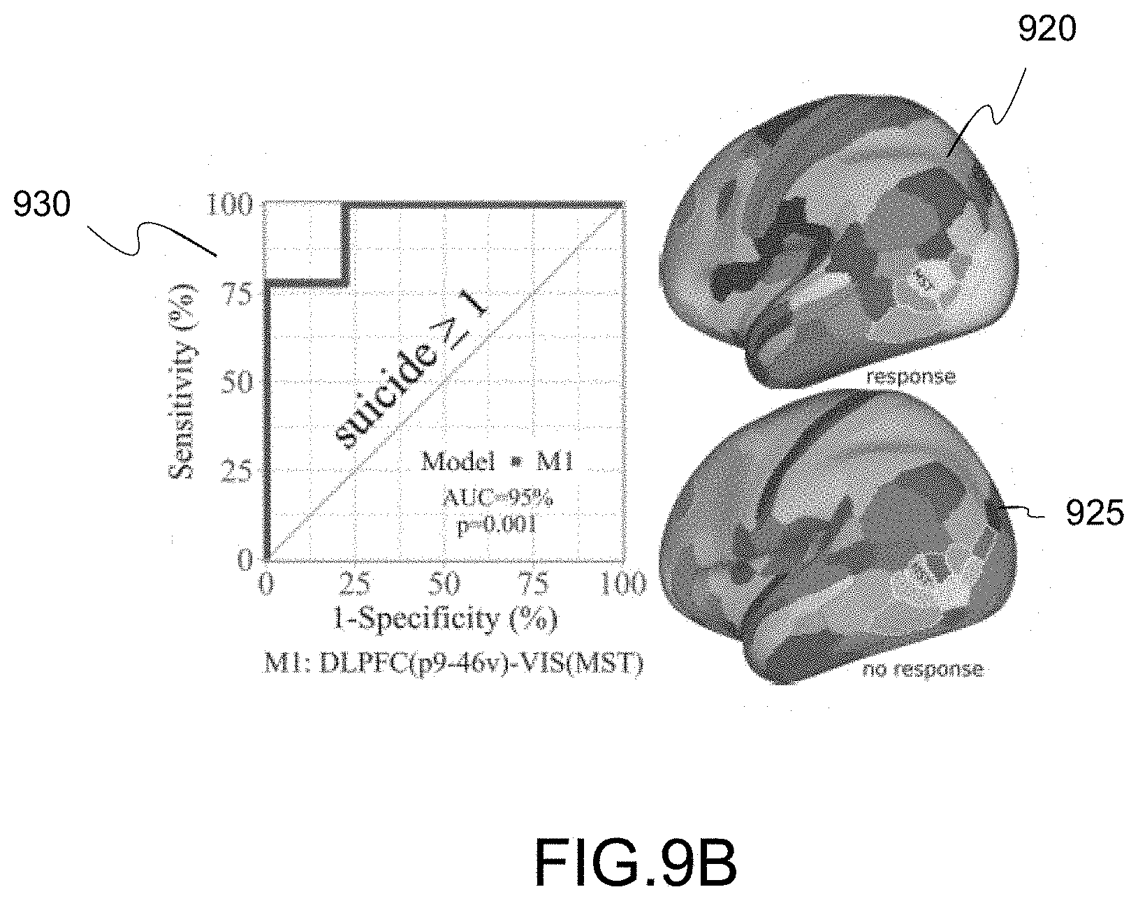 Patent US11779218 Figure 14 – System, method and computer-accessible medium for predicting response to electroconvulsice therapy based on brain functional connectivity patterns