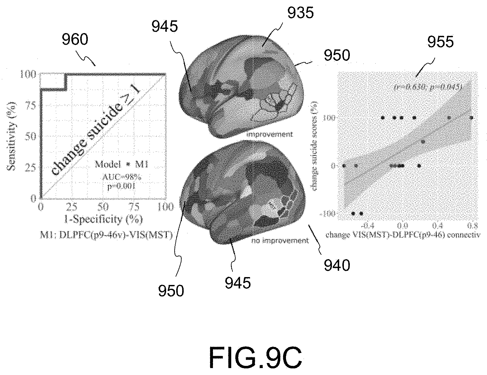 Patent US11779218 Figure 15 – System, method and computer-accessible medium for predicting response to electroconvulsice therapy based on brain functional connectivity patterns