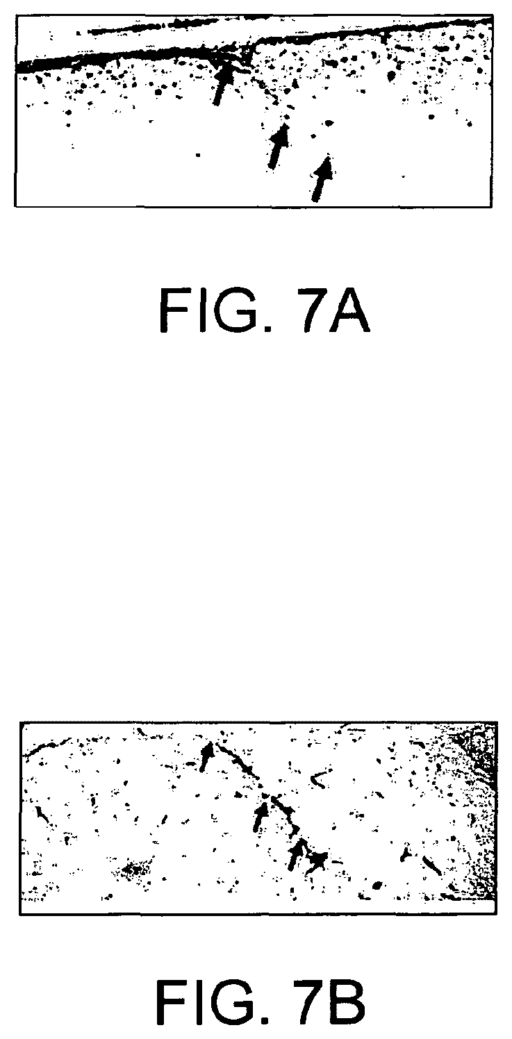 Patent US11779219 Figure 10 – Low-coherence interferometry and optical coherence tomography for image-guided surgical treatment of solid tumors
