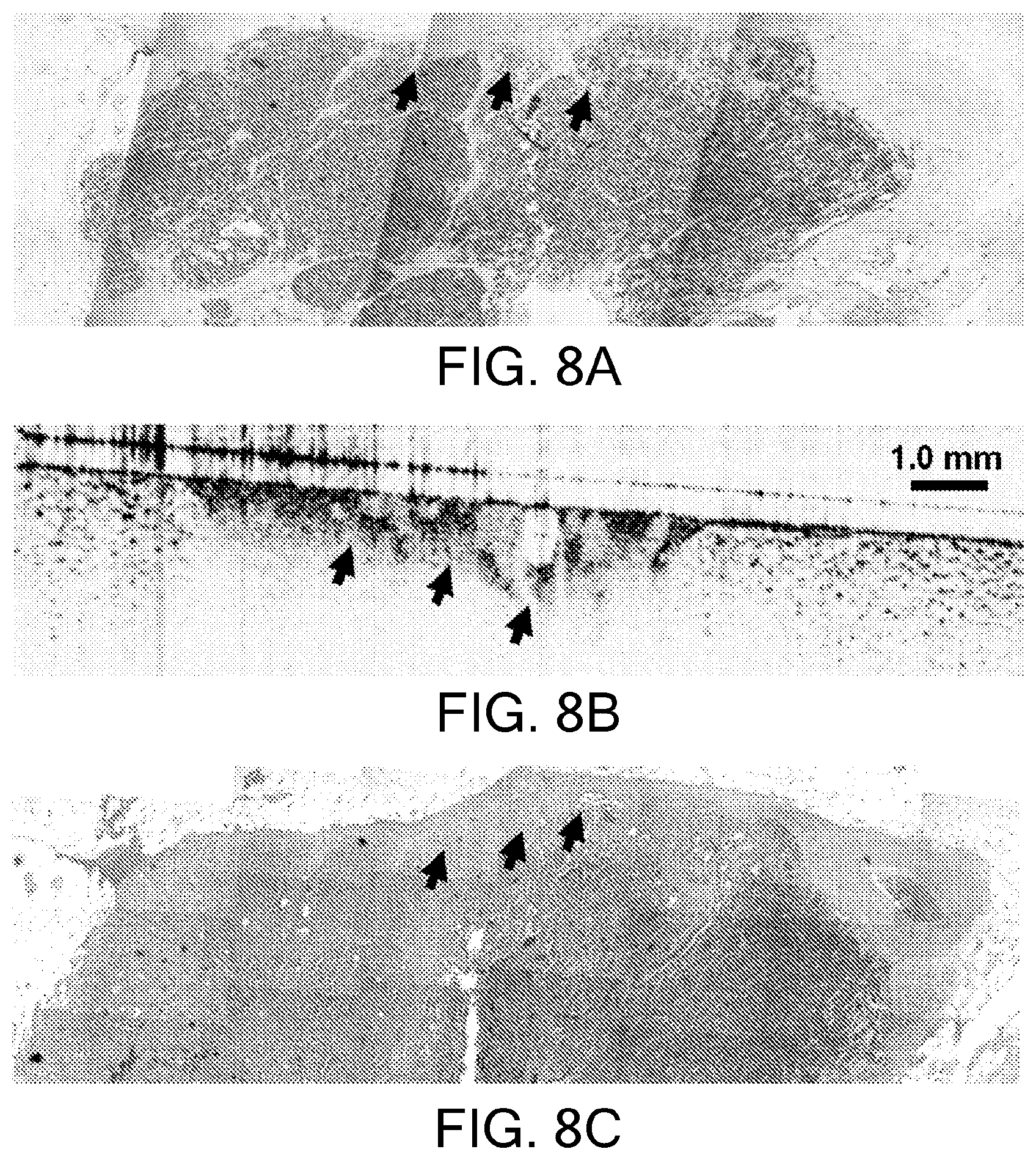 Patent US11779219 Figure 11 – Low-coherence interferometry and optical coherence tomography for image-guided surgical treatment of solid tumors
