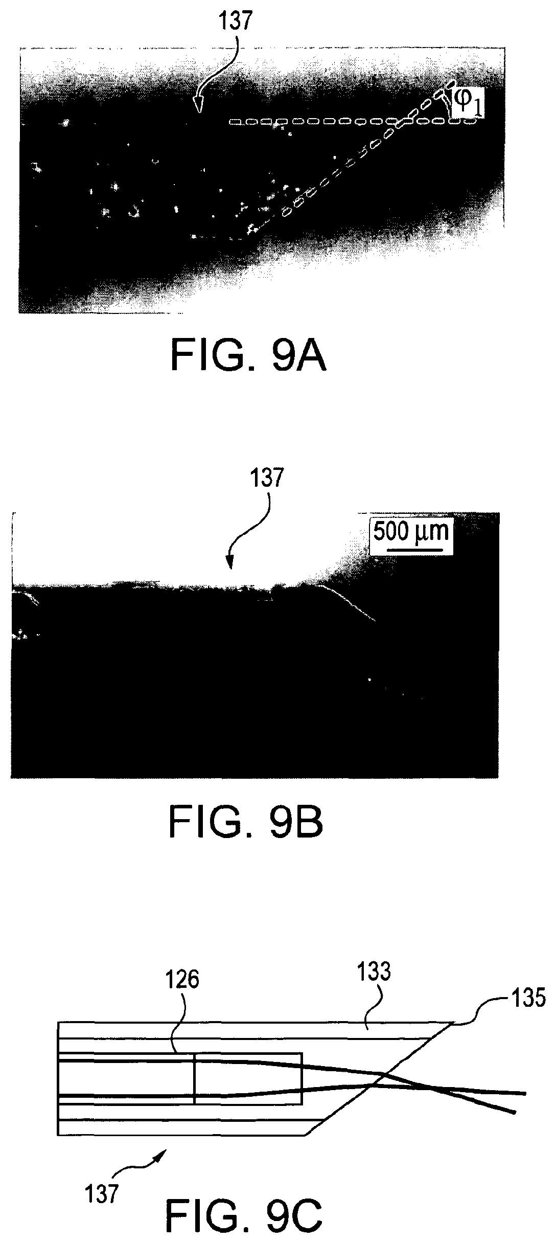 Patent US11779219 Figure 12 – Low-coherence interferometry and optical coherence tomography for image-guided surgical treatment of solid tumors