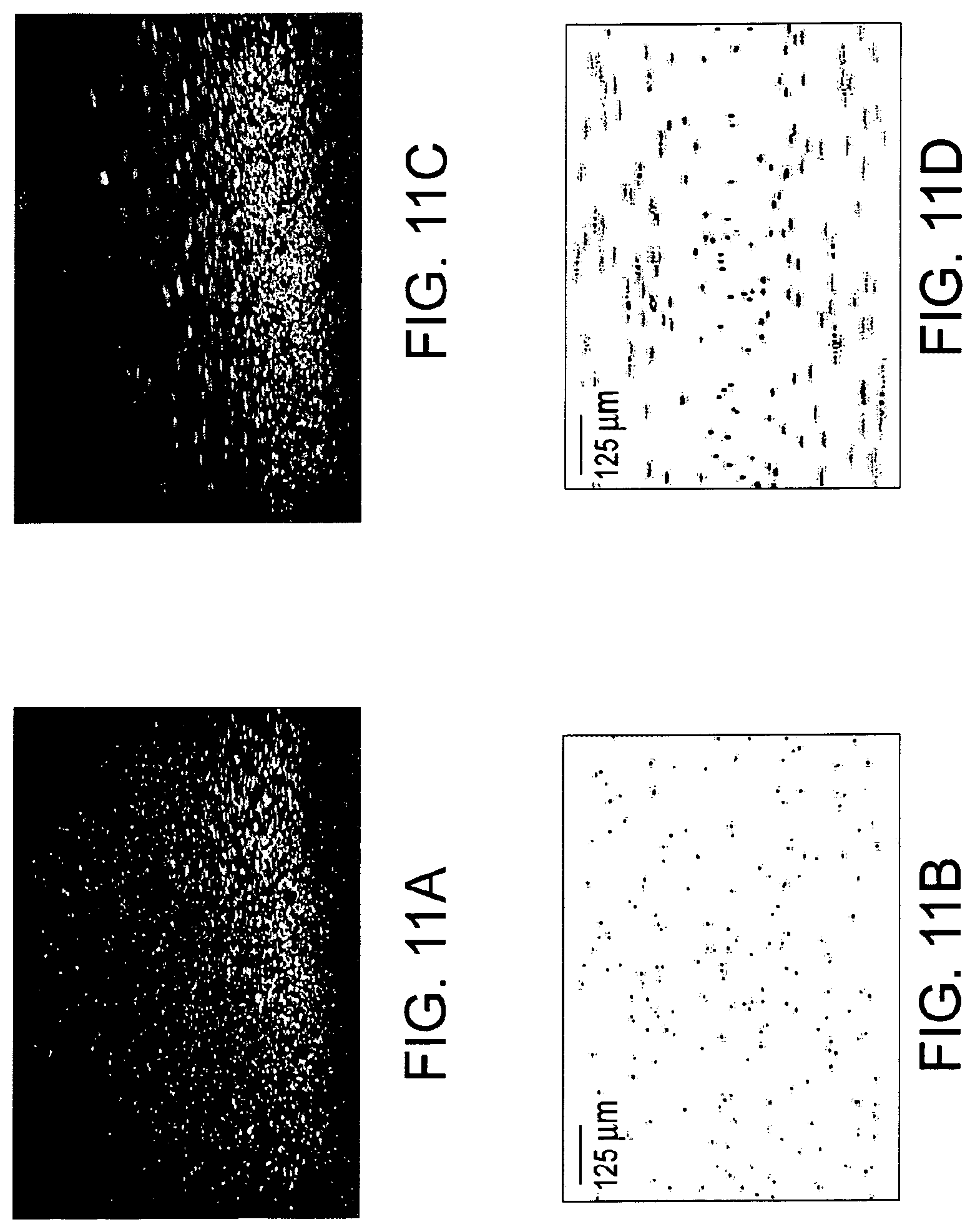 Patent US11779219 Figure 14 – Low-coherence interferometry and optical coherence tomography for image-guided surgical treatment of solid tumors