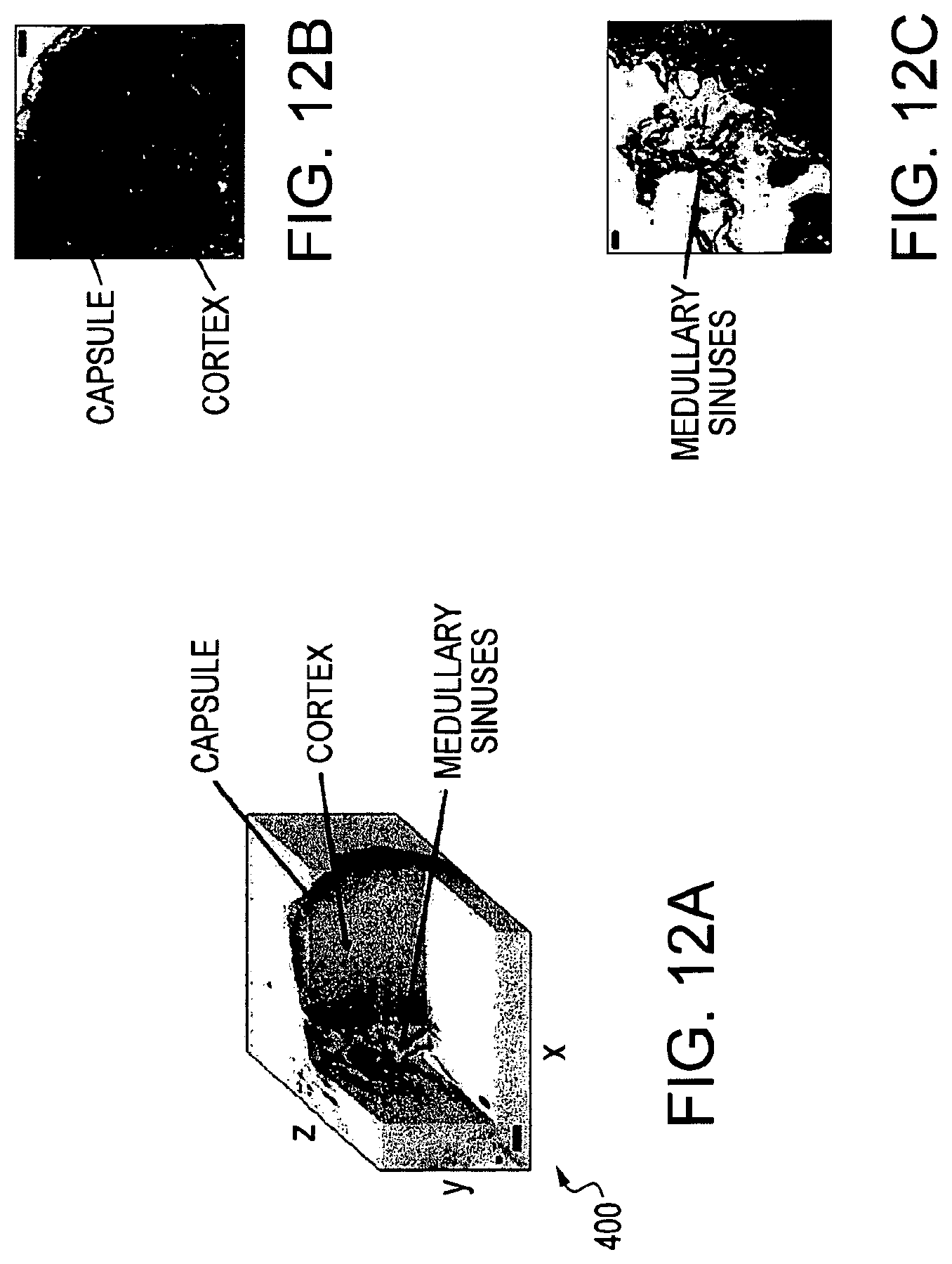 Patent US11779219 Figure 15 – Low-coherence interferometry and optical coherence tomography for image-guided surgical treatment of solid tumors