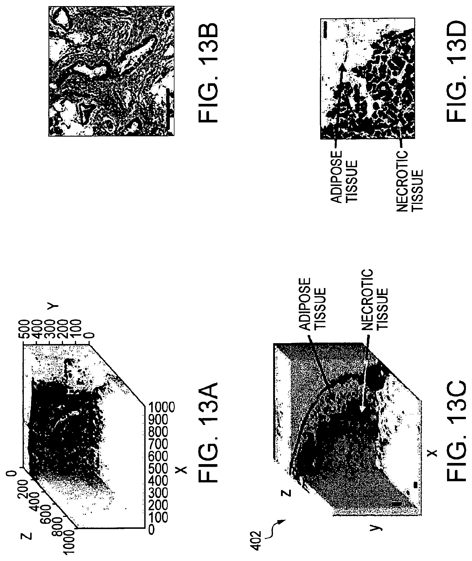 Patent US11779219 Figure 16 – Low-coherence interferometry and optical coherence tomography for image-guided surgical treatment of solid tumors