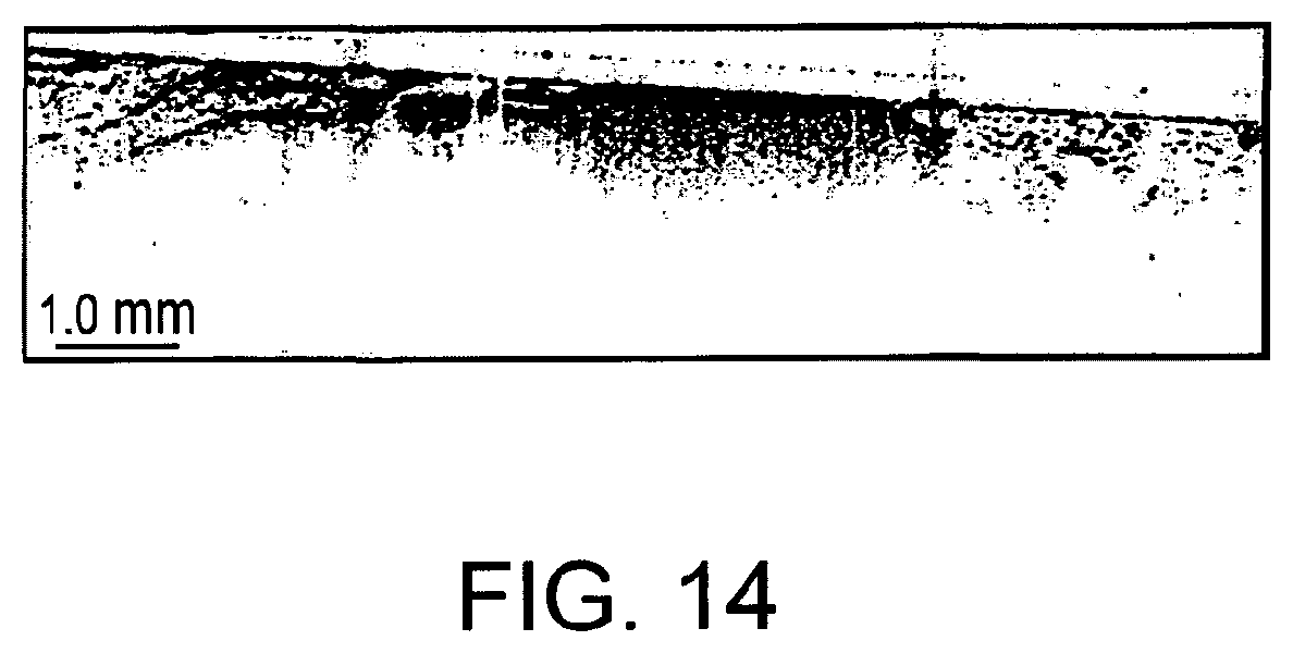 Patent US11779219 Figure 17 – Low-coherence interferometry and optical coherence tomography for image-guided surgical treatment of solid tumors