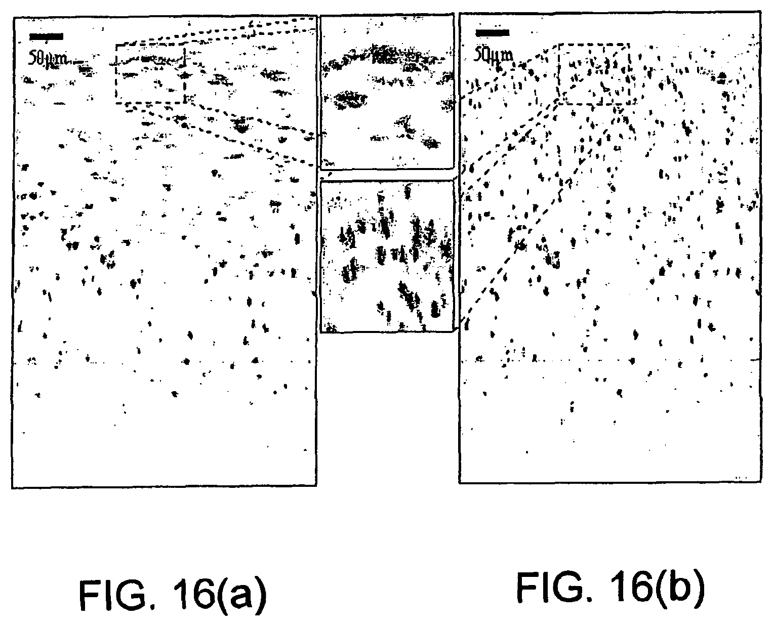 Patent US11779219 Figure 19 – Low-coherence interferometry and optical coherence tomography for image-guided surgical treatment of solid tumors