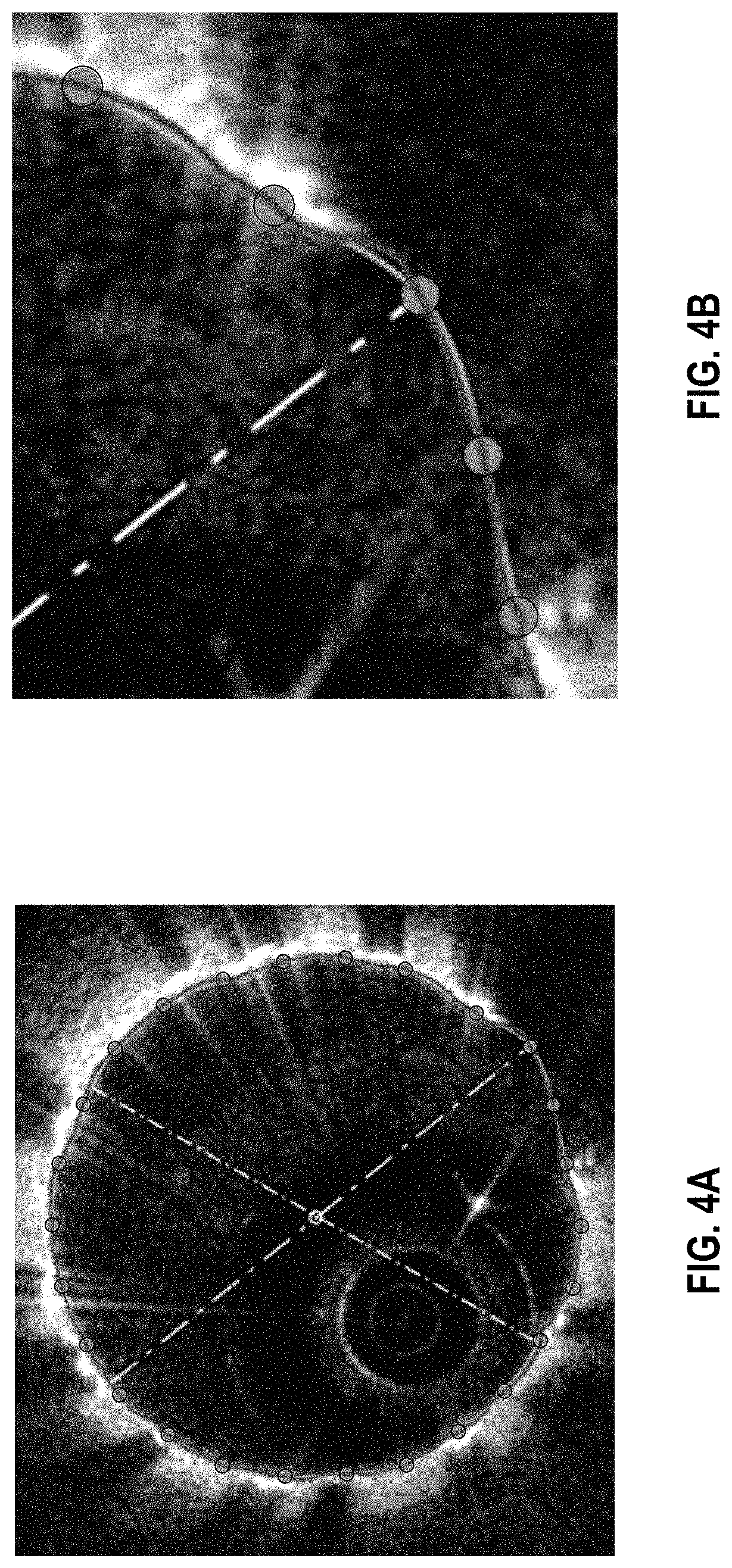 Patent US11779221 Figure 4 – Apparatus, method and storage medium for lumen curve simplification for editing in one or more images, such as in optical coherence tomography images