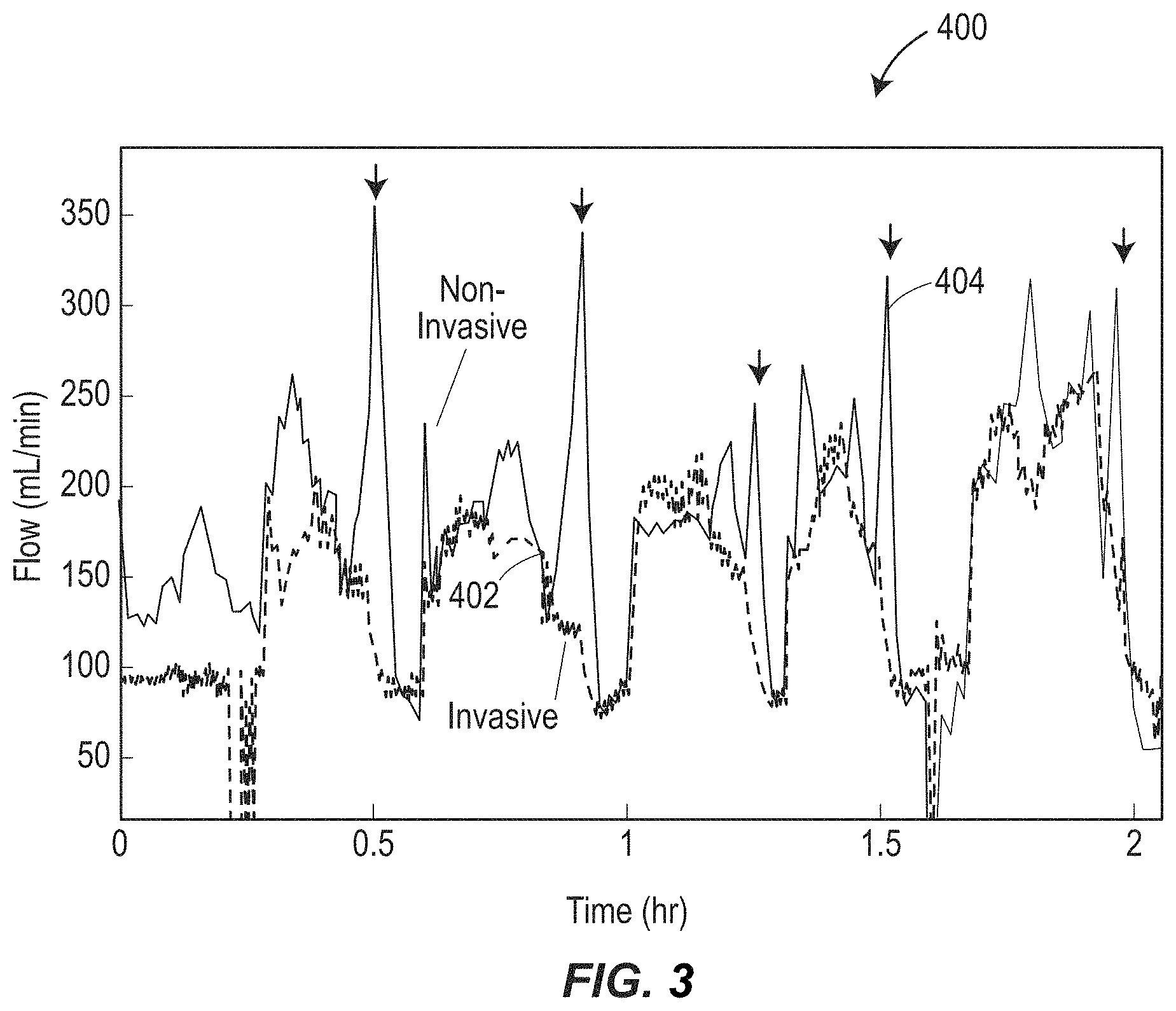 Patent US11779235 Figure 3 – Multi-sensor intracranial pressure monitor for cerebral hemodynamic monitoring