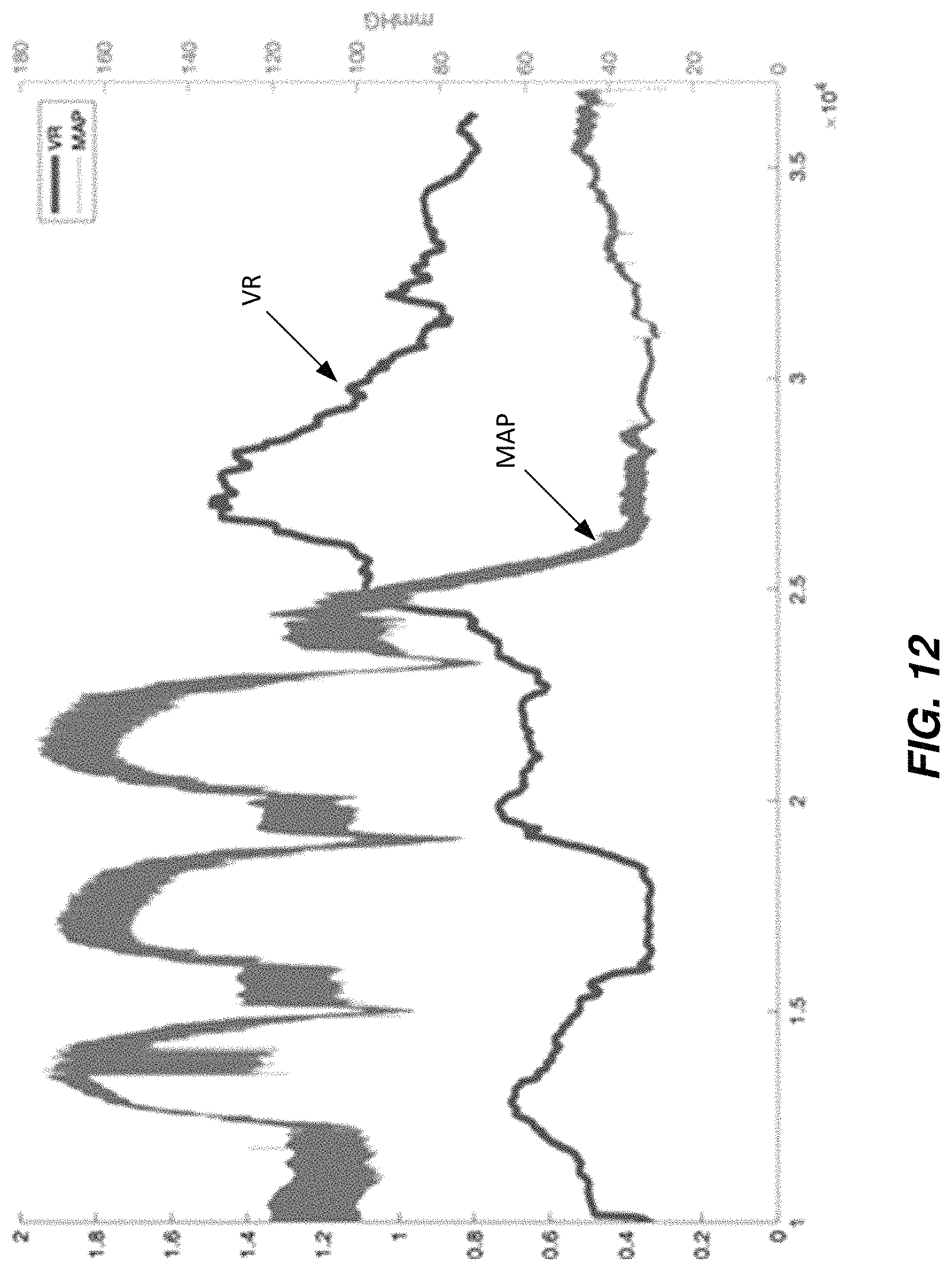 Patent US11779235 Figure 11 – Multi-sensor intracranial pressure monitor for cerebral hemodynamic monitoring