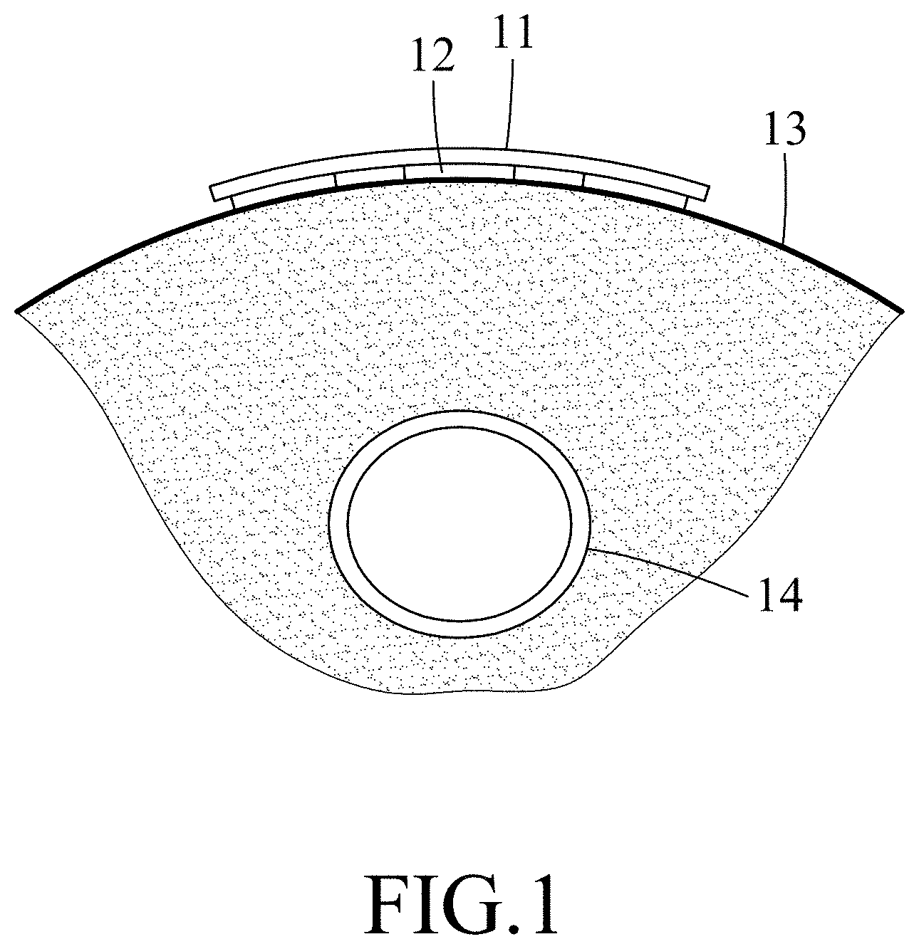 Patent US11779236 Figure 1 – Vascular assessment device