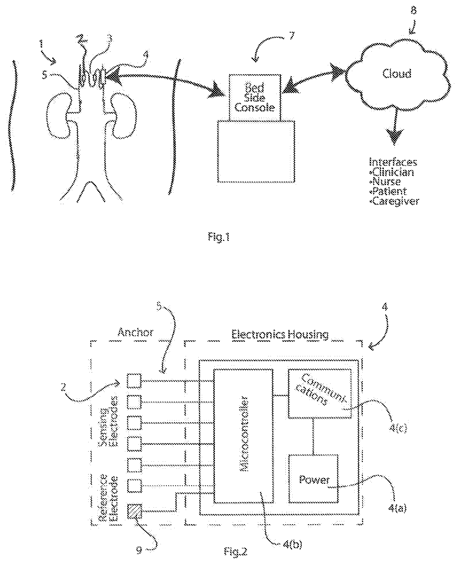 Patent US11779238 — Implantable sensors for vascular monitoring — Figure 1