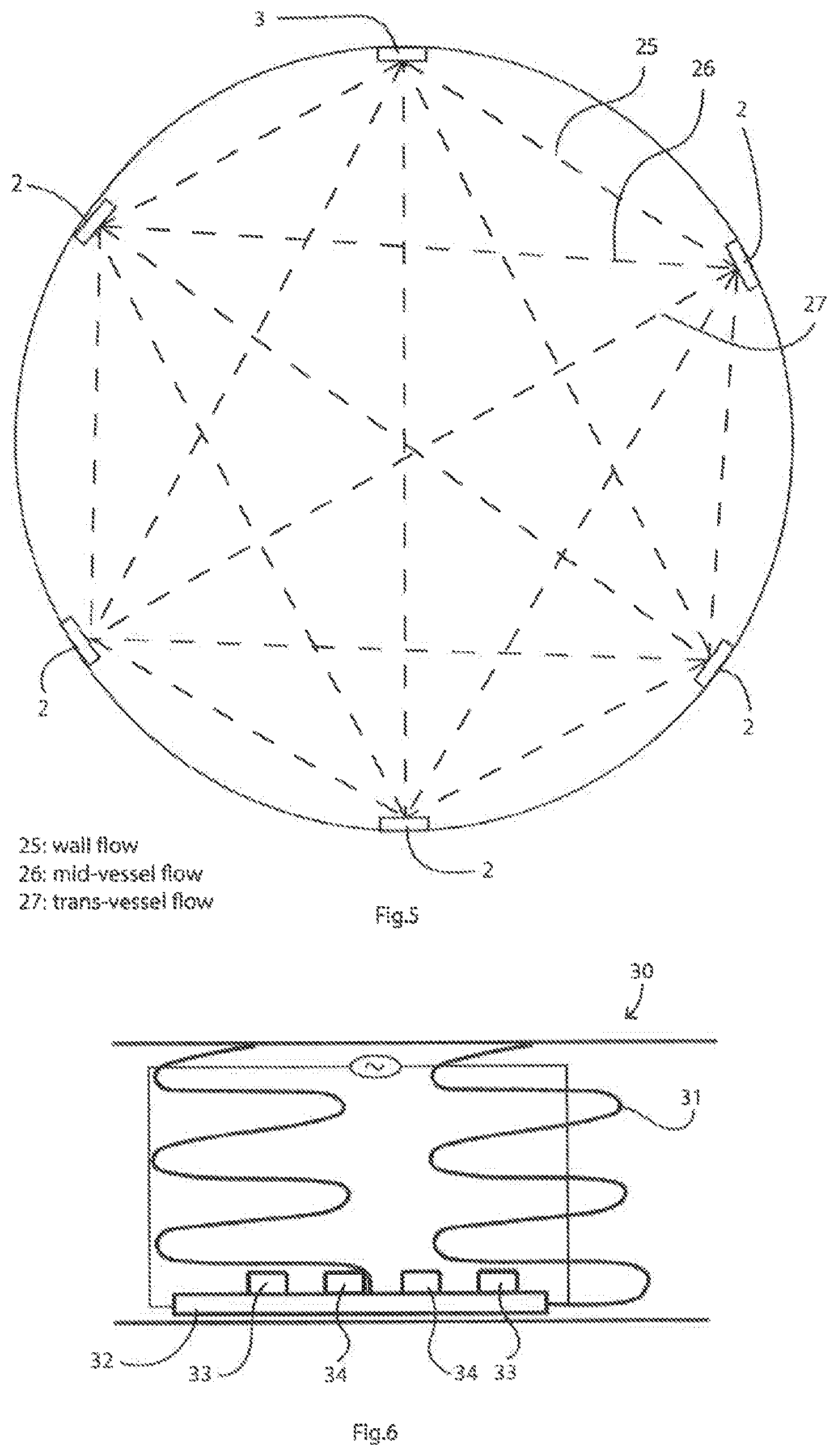 Patent US11779238 Figure 3 – Implantable sensors for vascular monitoring