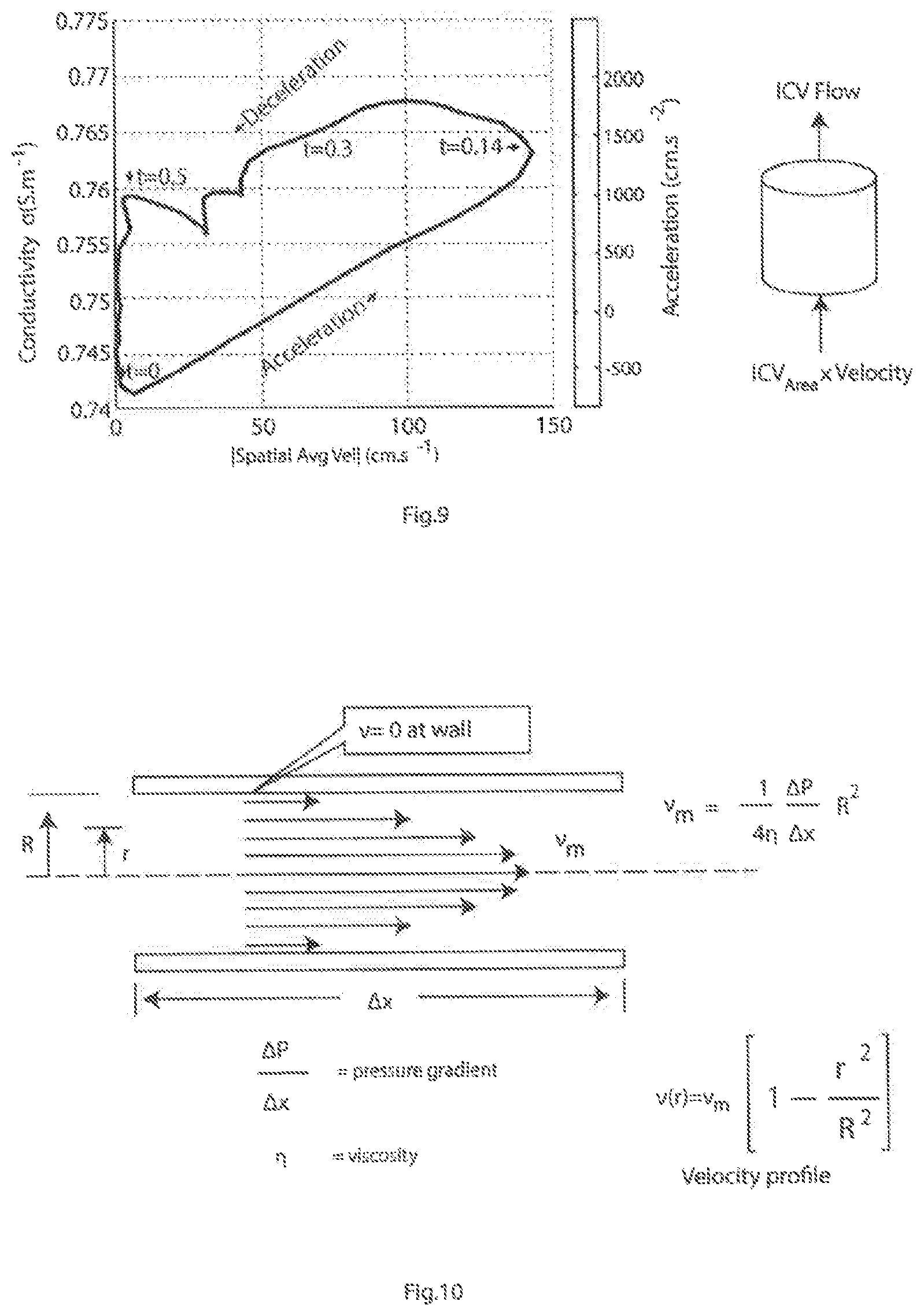 Patent US11779238 Figure 6 – Implantable sensors for vascular monitoring