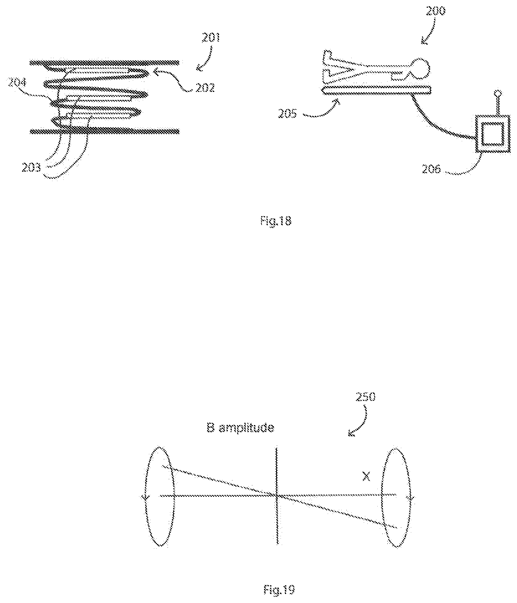 Patent US11779238 Figure 12 – Implantable sensors for vascular monitoring
