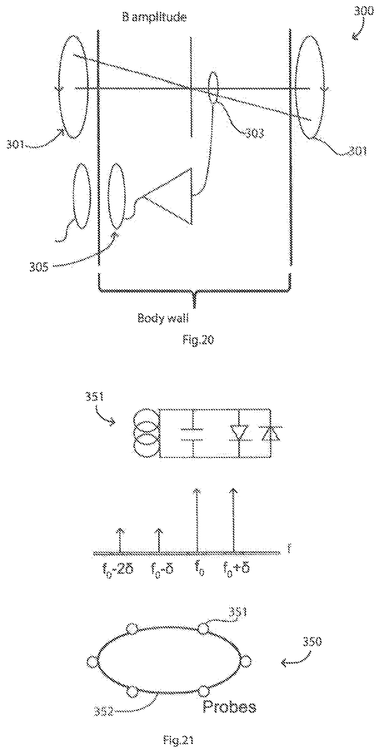 Patent US11779238 Figure 13 – Implantable sensors for vascular monitoring