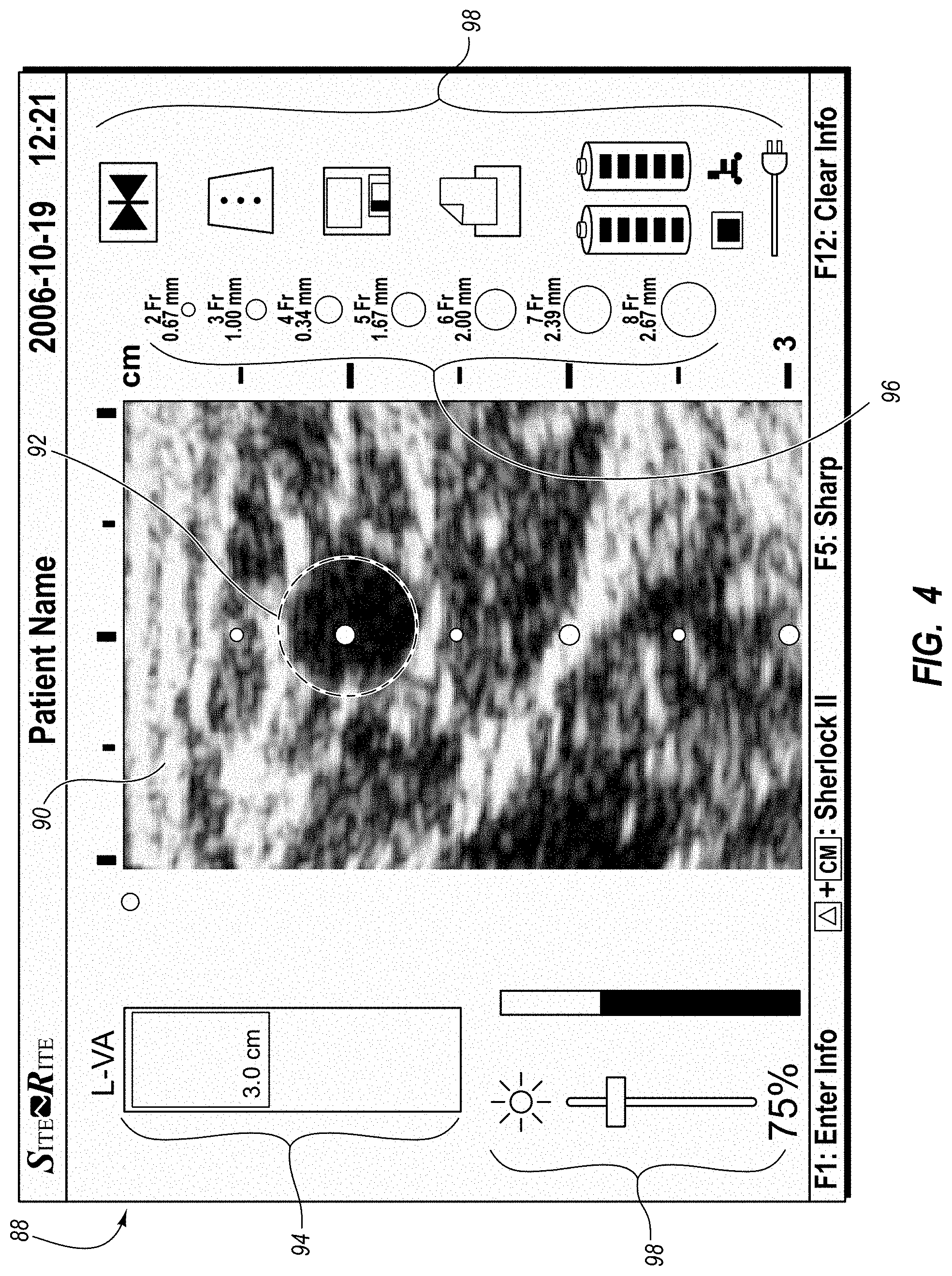 Patent US11779240 Figure 3 – Systems and methods for breaching a sterile field for intravascular placement of a catheter