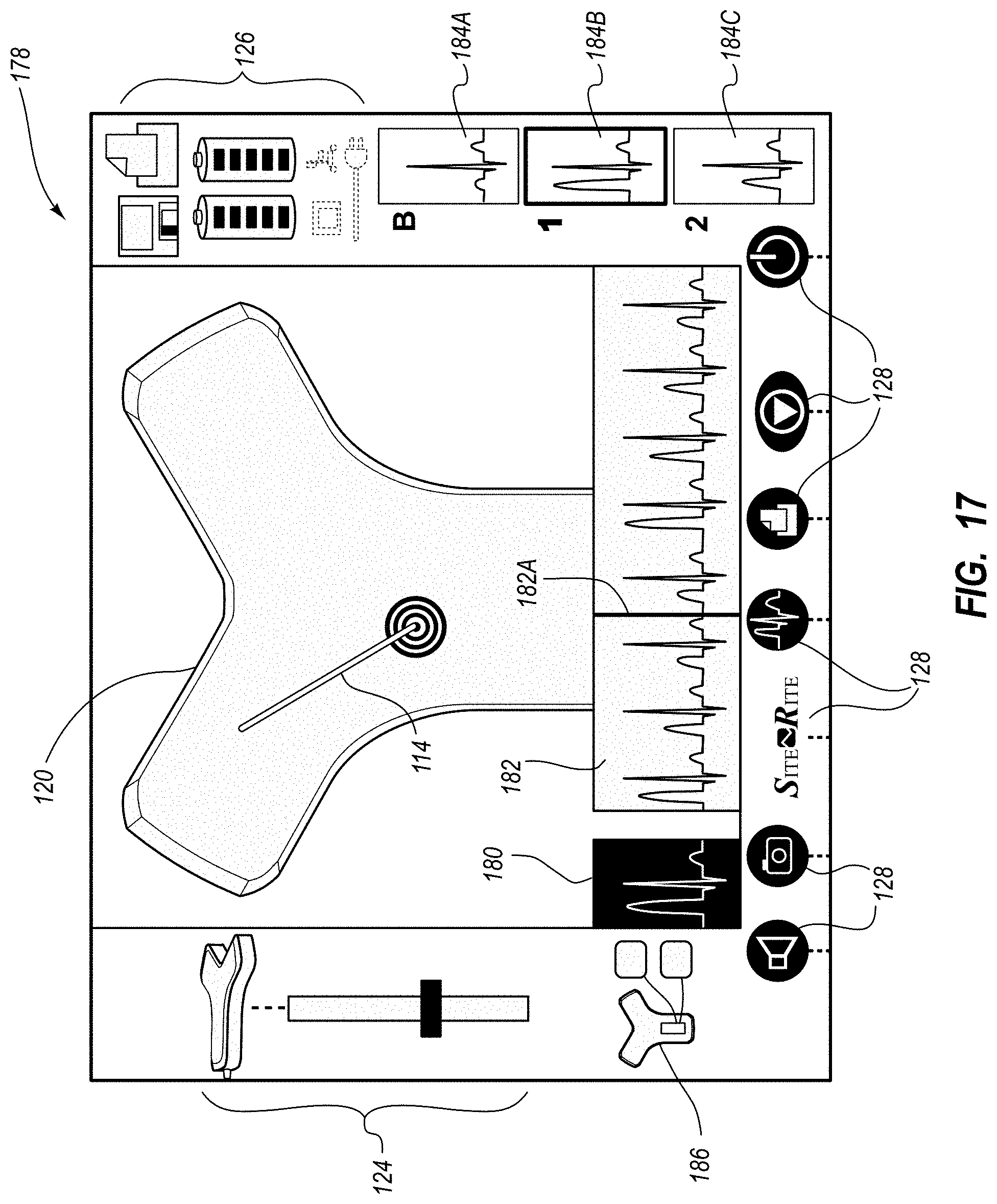 Patent US11779240 Figure 18 – Systems and methods for breaching a sterile field for intravascular placement of a catheter