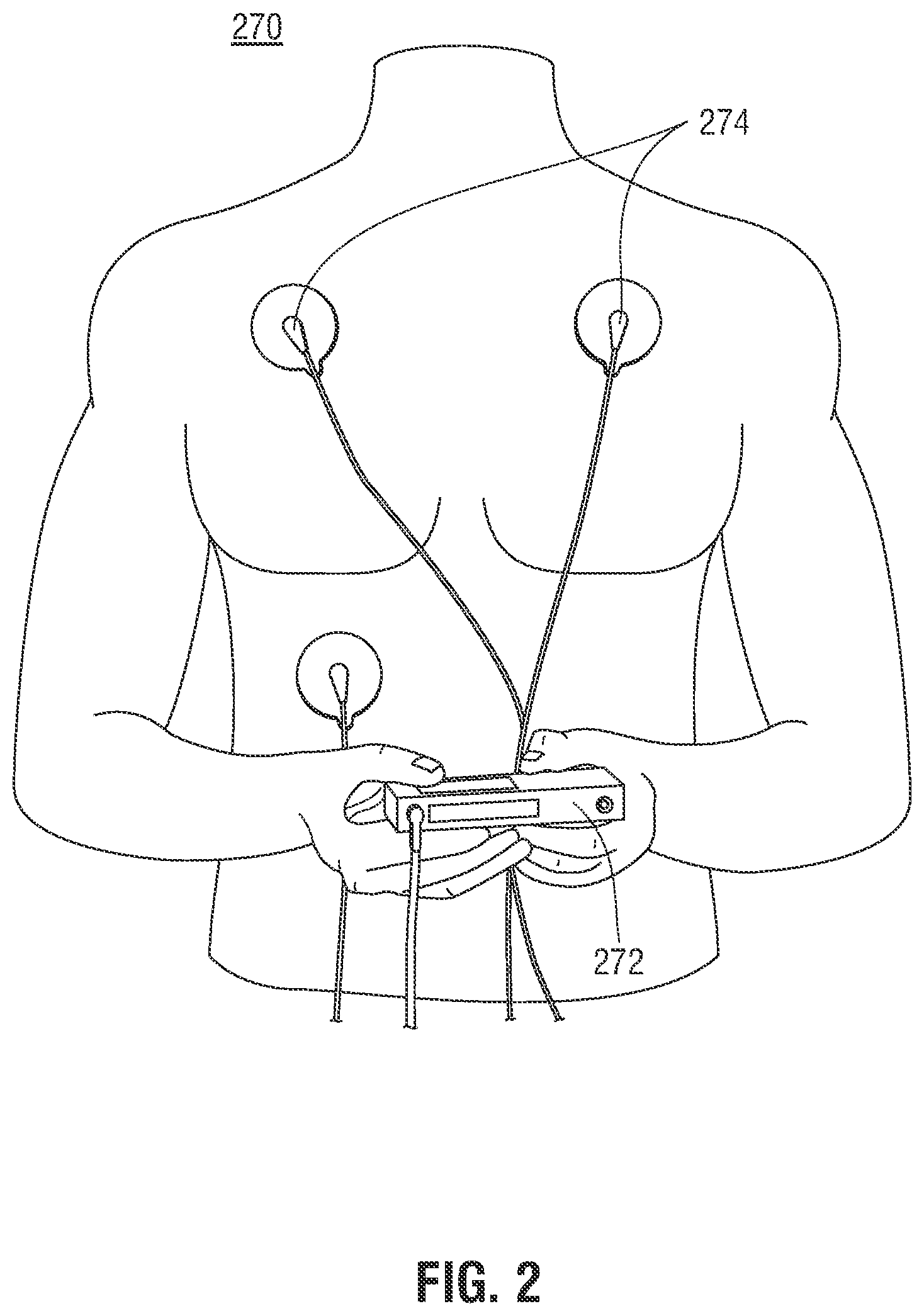 Patent US11779241 Figure 2 – Systems, methods, and computer-readable media of estimating thoracic cavity movement during respiration