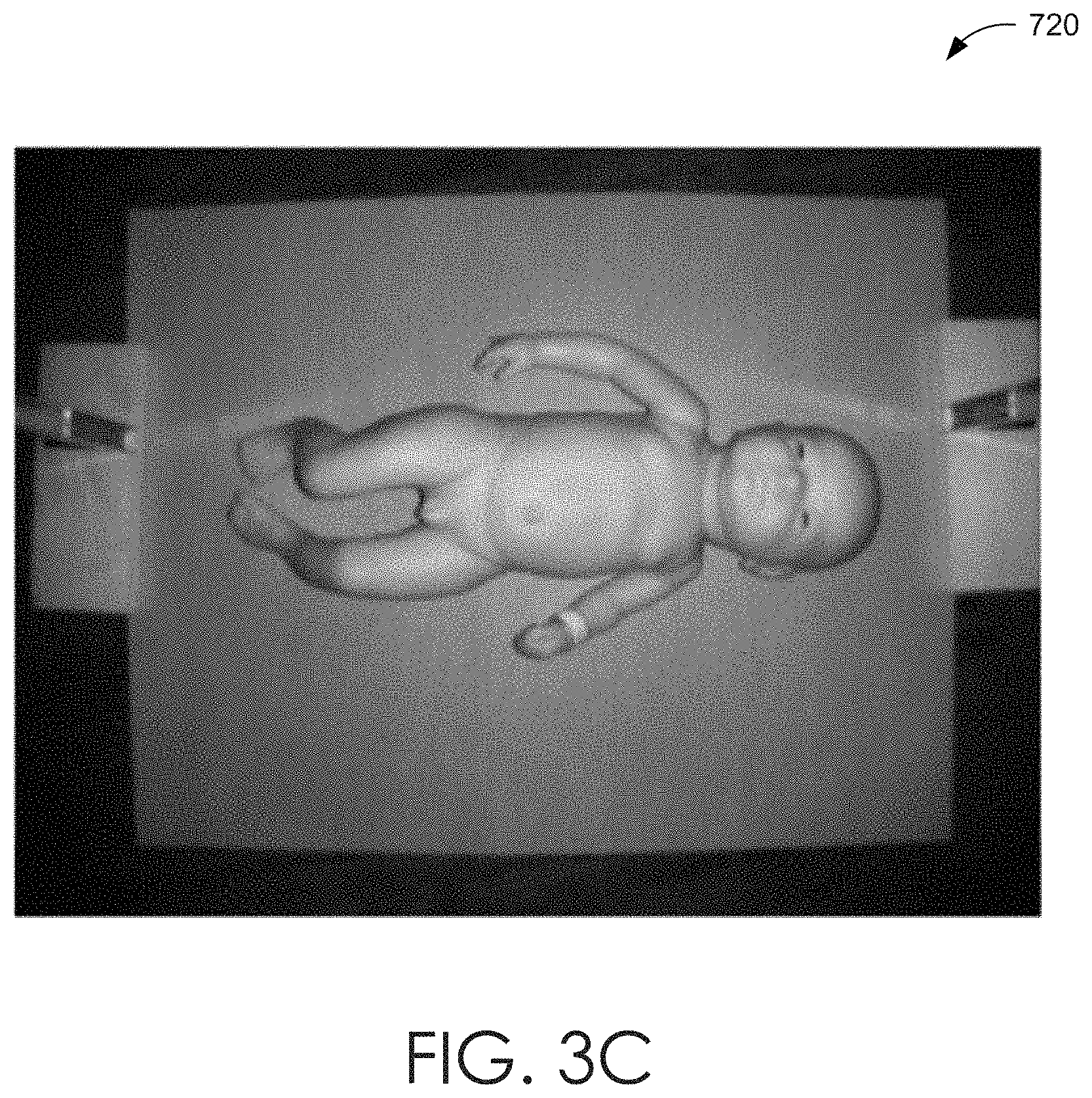 Patent US11779242 Figure 7 – Systems and methods to estimate human length