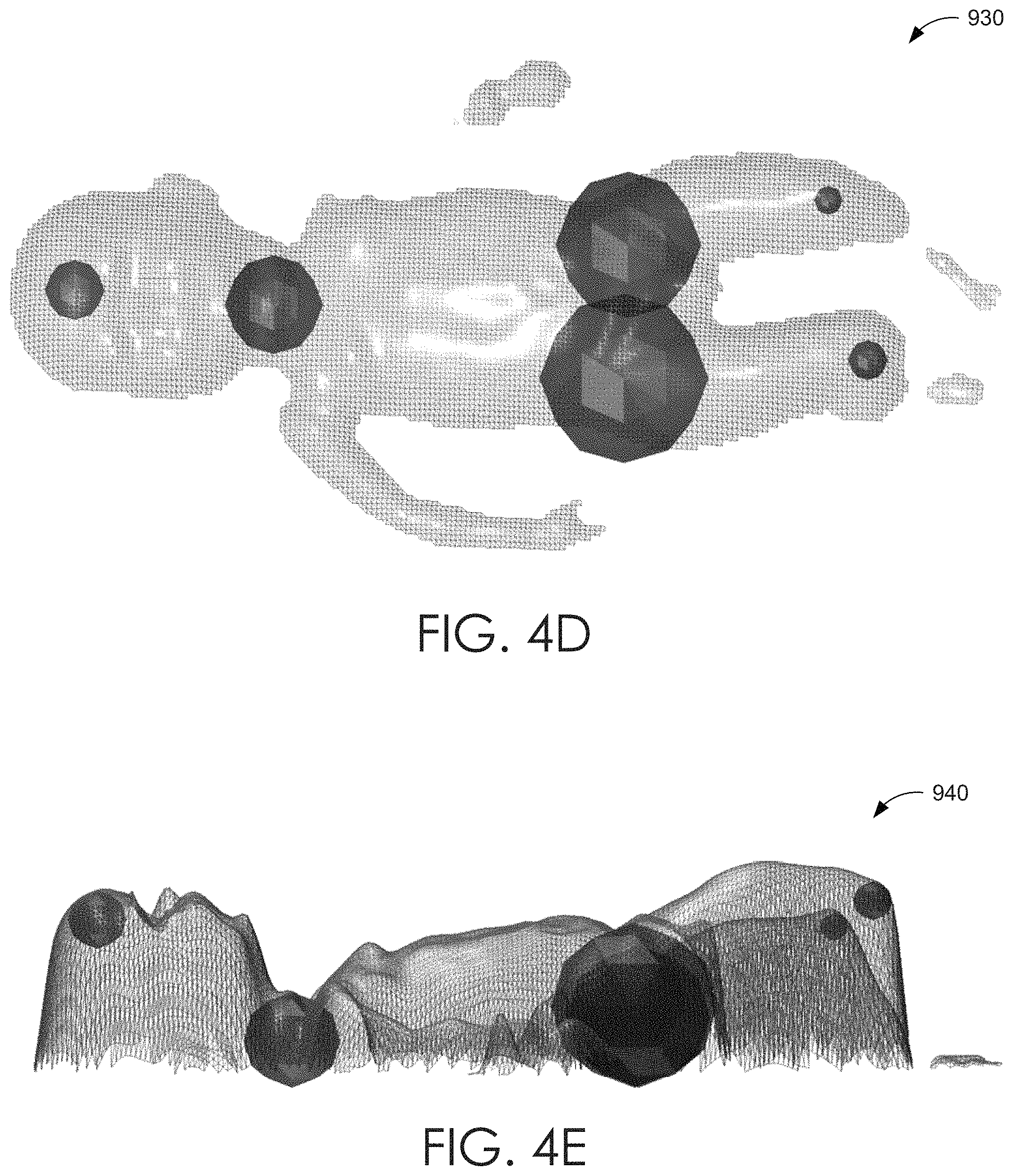 Patent US11779242 Figure 13 – Systems and methods to estimate human length