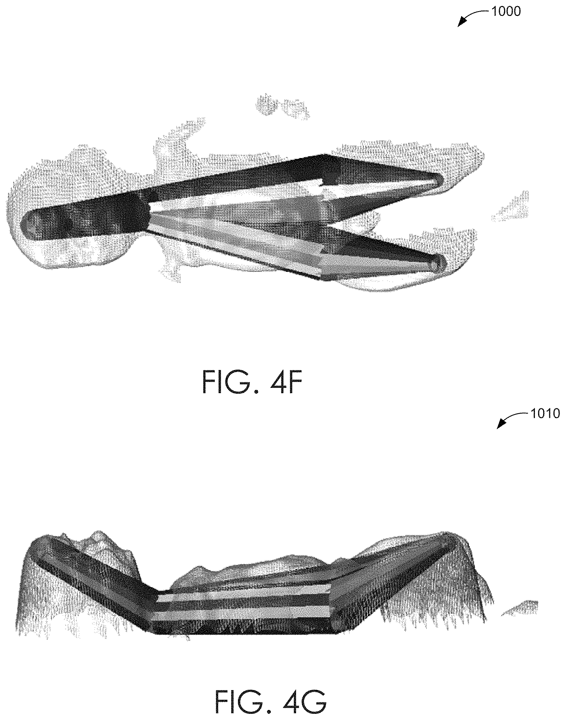 Patent US11779242 Figure 14 – Systems and methods to estimate human length
