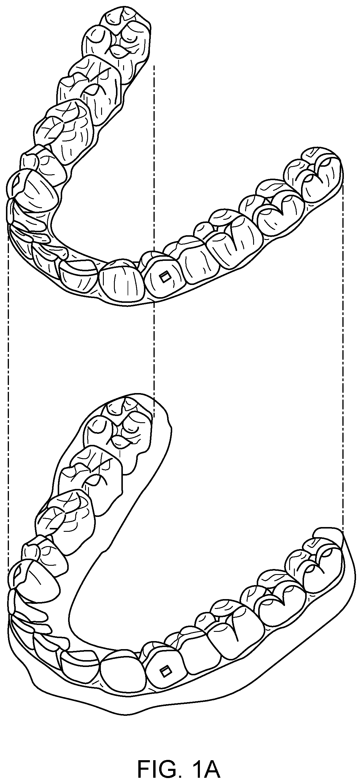 Patent US11779243 Figure 1 – Customized aligner change indicator