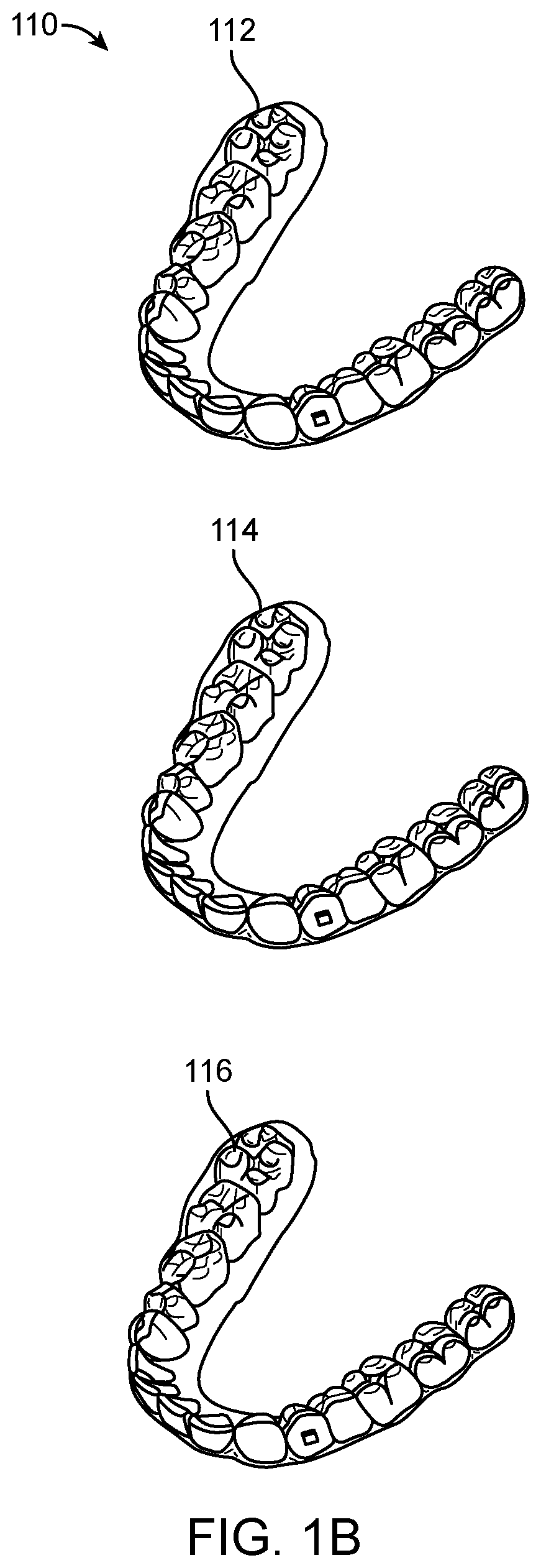 Patent US11779243 Figure 2 – Customized aligner change indicator
