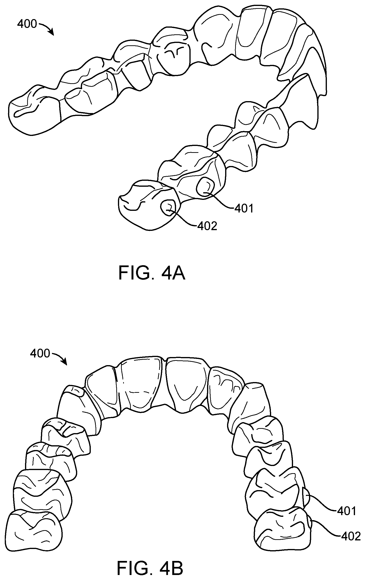 Patent US11779243 Figure 6 – Customized aligner change indicator