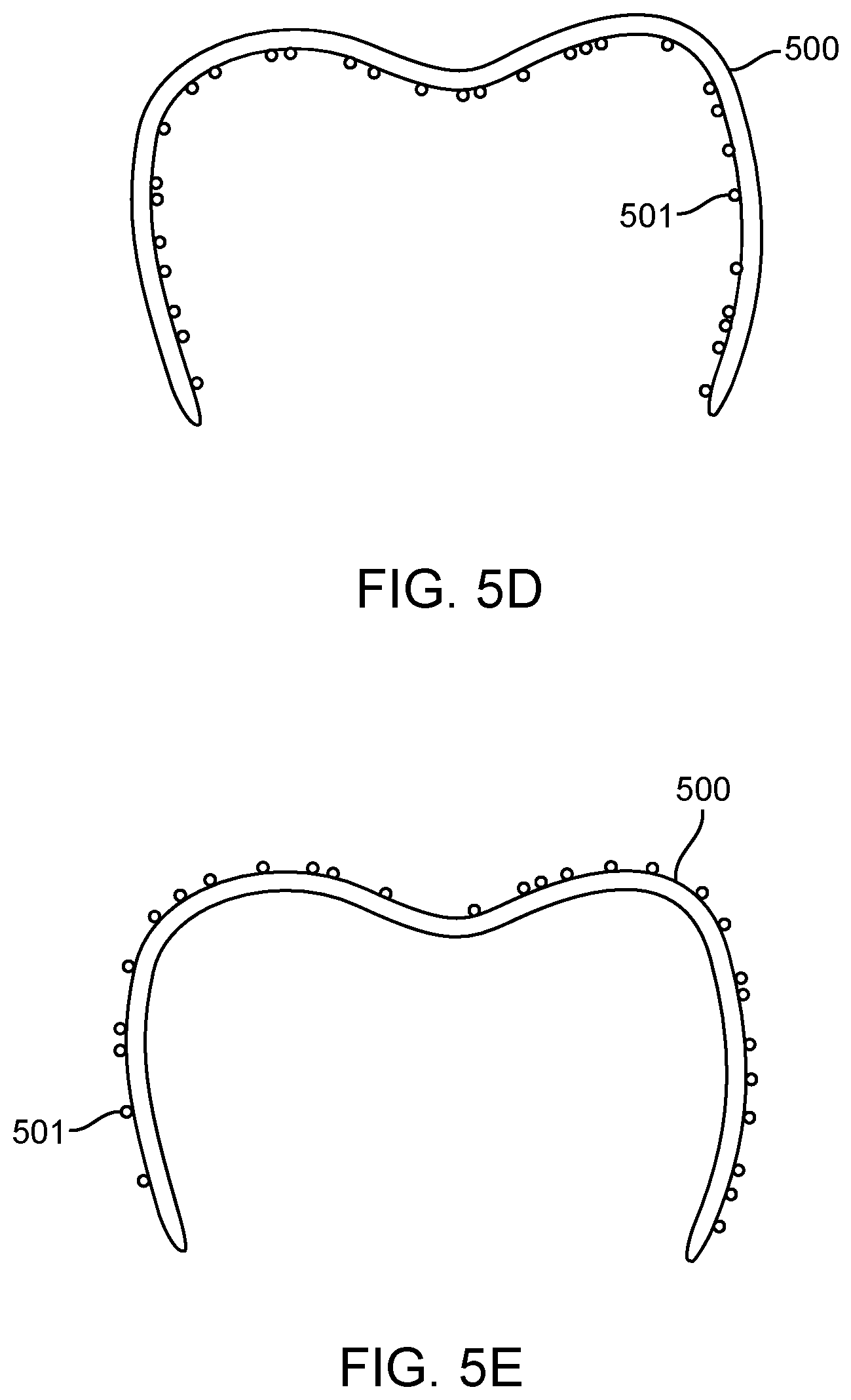 Patent US11779243 Figure 11 – Customized aligner change indicator