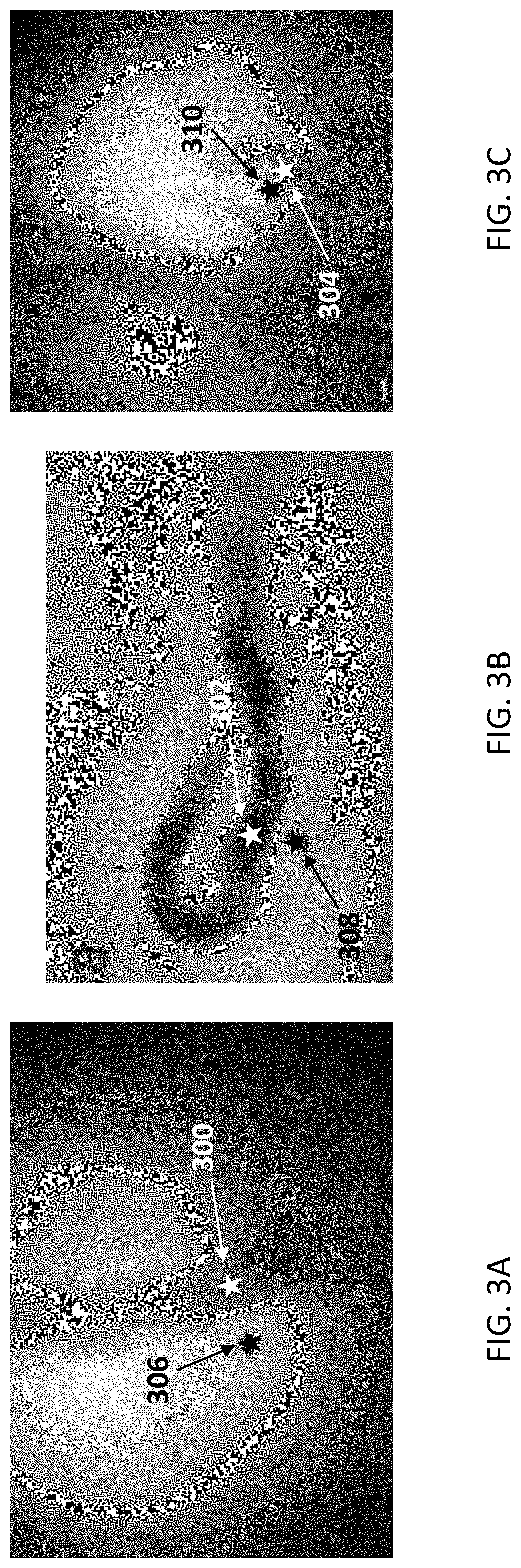 Patent US11779246 Figure 5 – Hemoglobin measurement from a single vessel