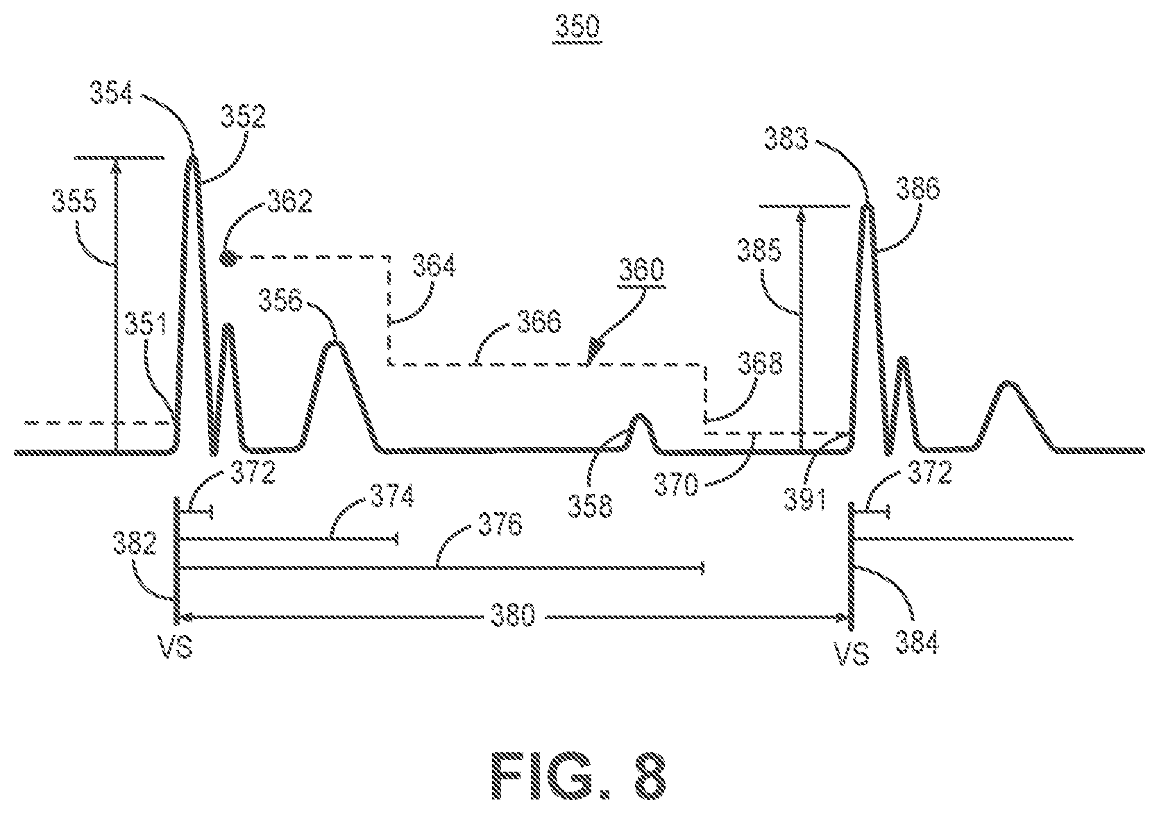 Patent US11779255 Figure 11 – Medical device and method for predicting cardiac event sensing based on sensing control parameters