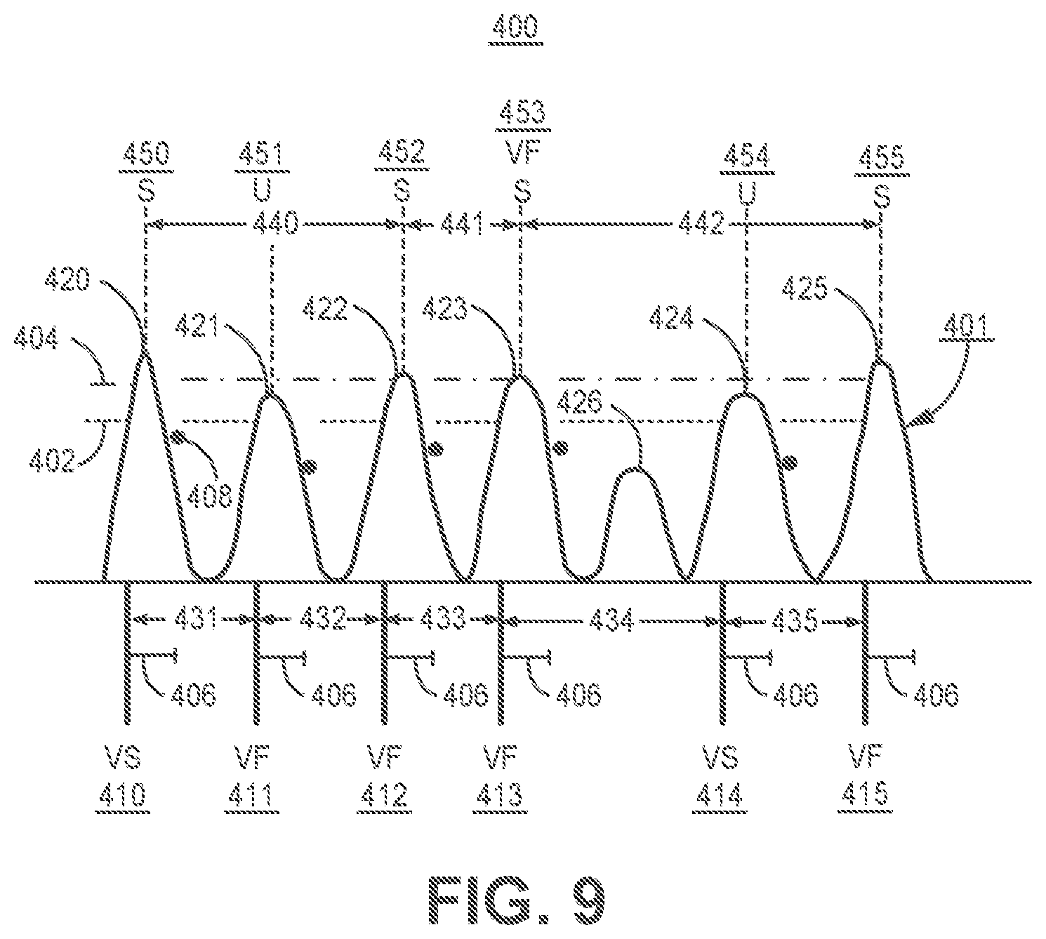 Patent US11779255 Figure 12 – Medical device and method for predicting cardiac event sensing based on sensing control parameters