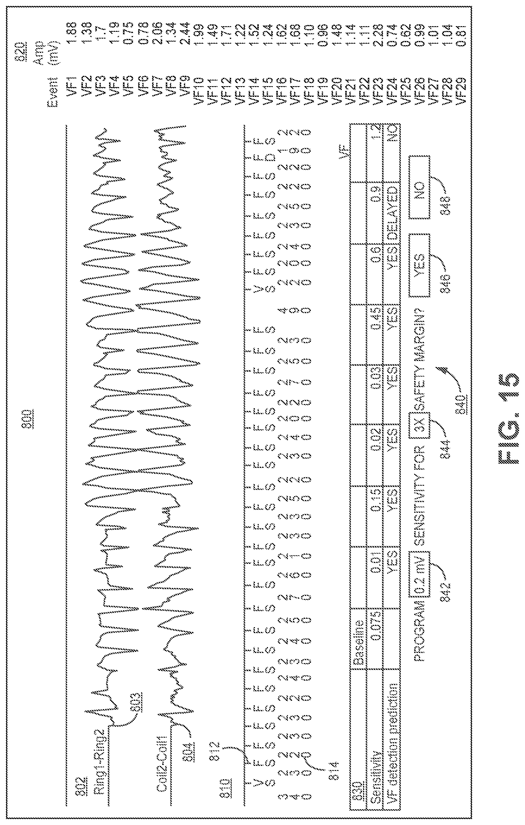 Patent US11779255 Figure 18 – Medical device and method for predicting cardiac event sensing based on sensing control parameters