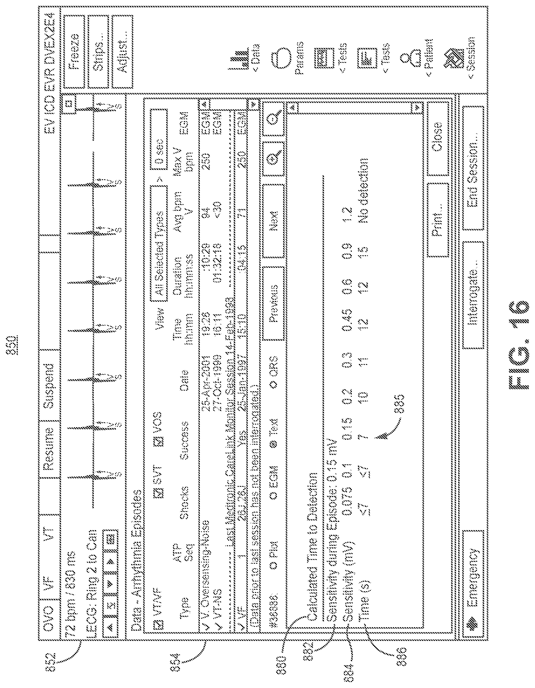 Patent US11779255 Figure 19 – Medical device and method for predicting cardiac event sensing based on sensing control parameters