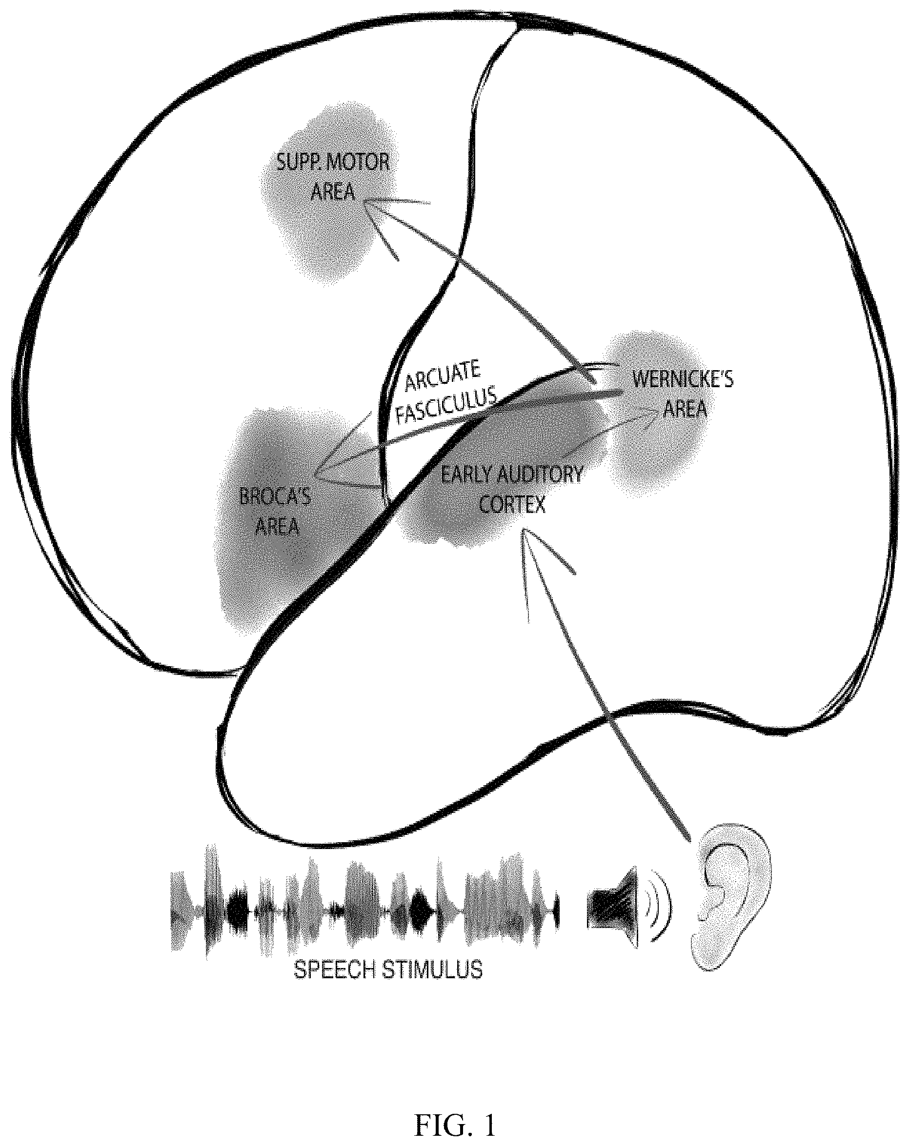 Patent US11779256 — Rapid mapping of language function and motor function without subject participation — Figure 1