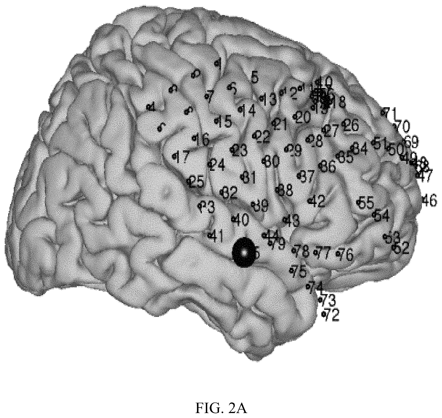 Patent US11779256 Figure 2 – Rapid mapping of language function and motor function without subject participation