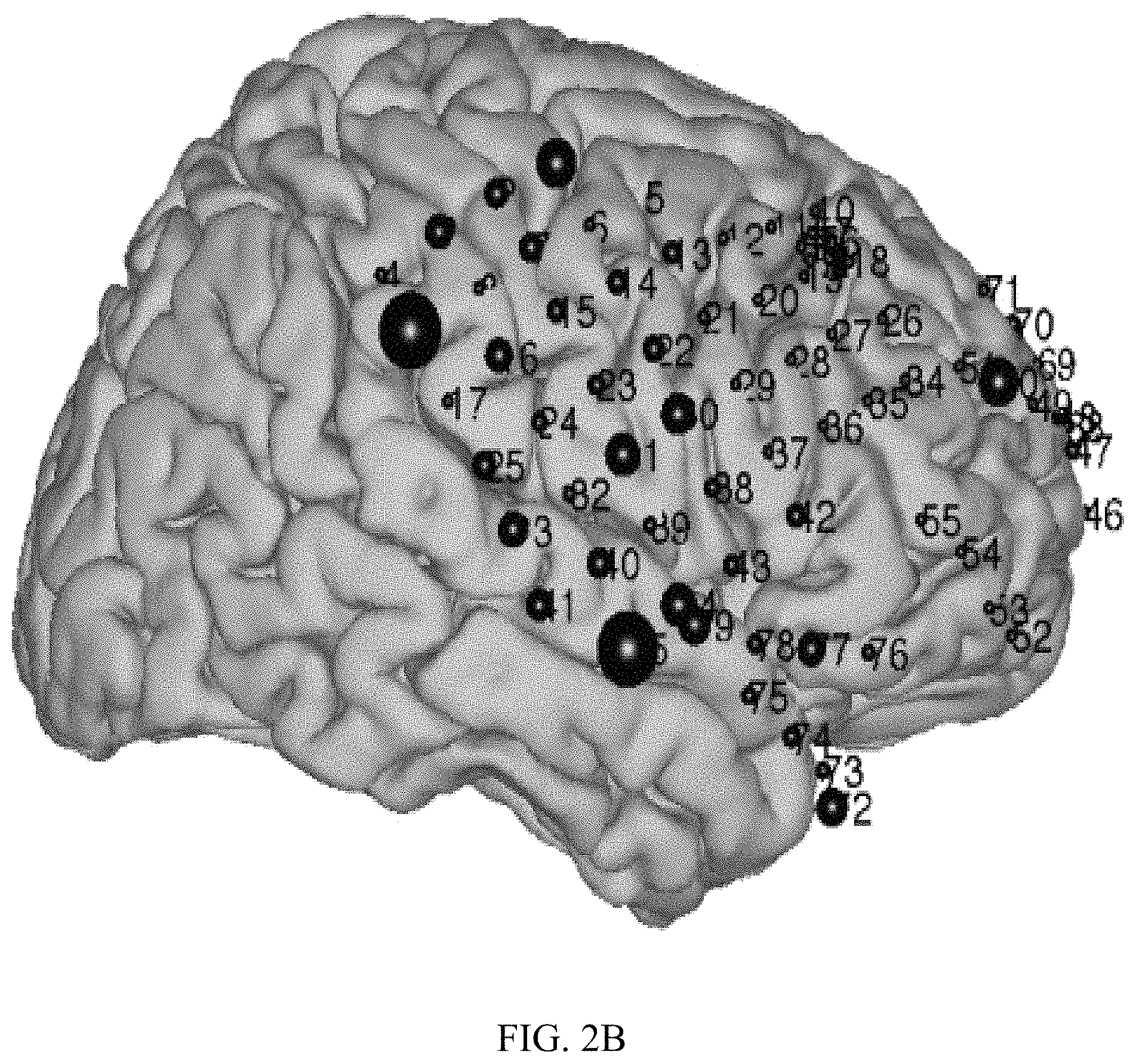 Patent US11779256 Figure 3 – Rapid mapping of language function and motor function without subject participation