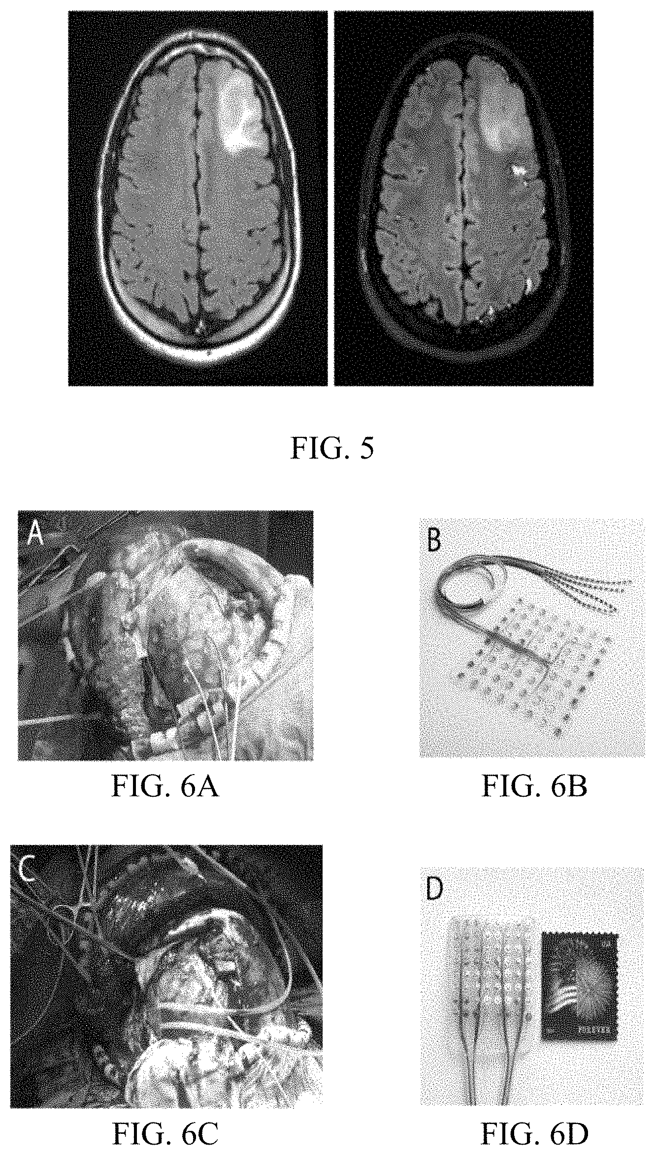 Patent US11779256 Figure 13 – Rapid mapping of language function and motor function without subject participation