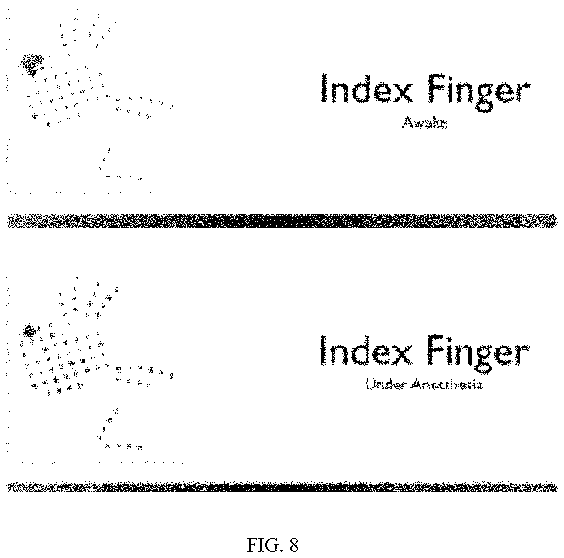 Patent US11779256 Figure 18 – Rapid mapping of language function and motor function without subject participation