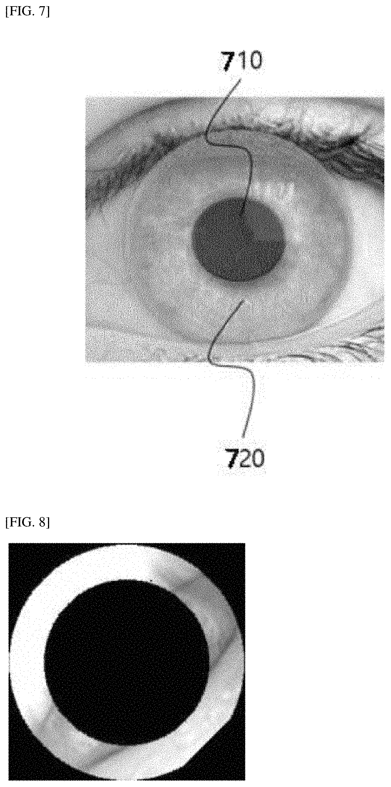 Patent US11779257 Figure 4 – 3-dimensional measurement method for eye movement and fully automated deep-learning based system for vertigo diagnosis