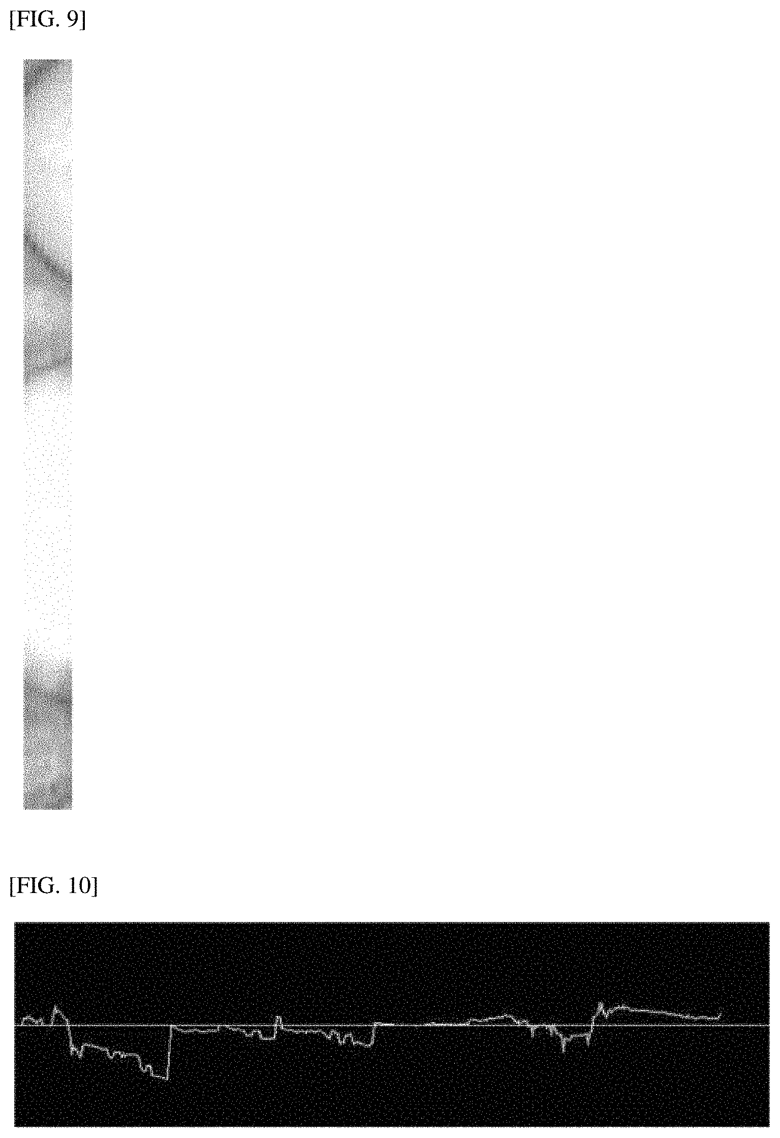 Patent US11779257 Figure 5 – 3-dimensional measurement method for eye movement and fully automated deep-learning based system for vertigo diagnosis