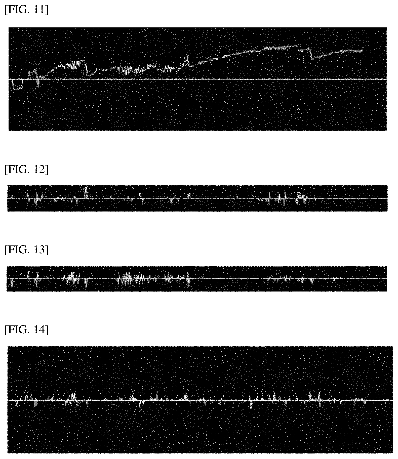 Patent US11779257 Figure 6 – 3-dimensional measurement method for eye movement and fully automated deep-learning based system for vertigo diagnosis
