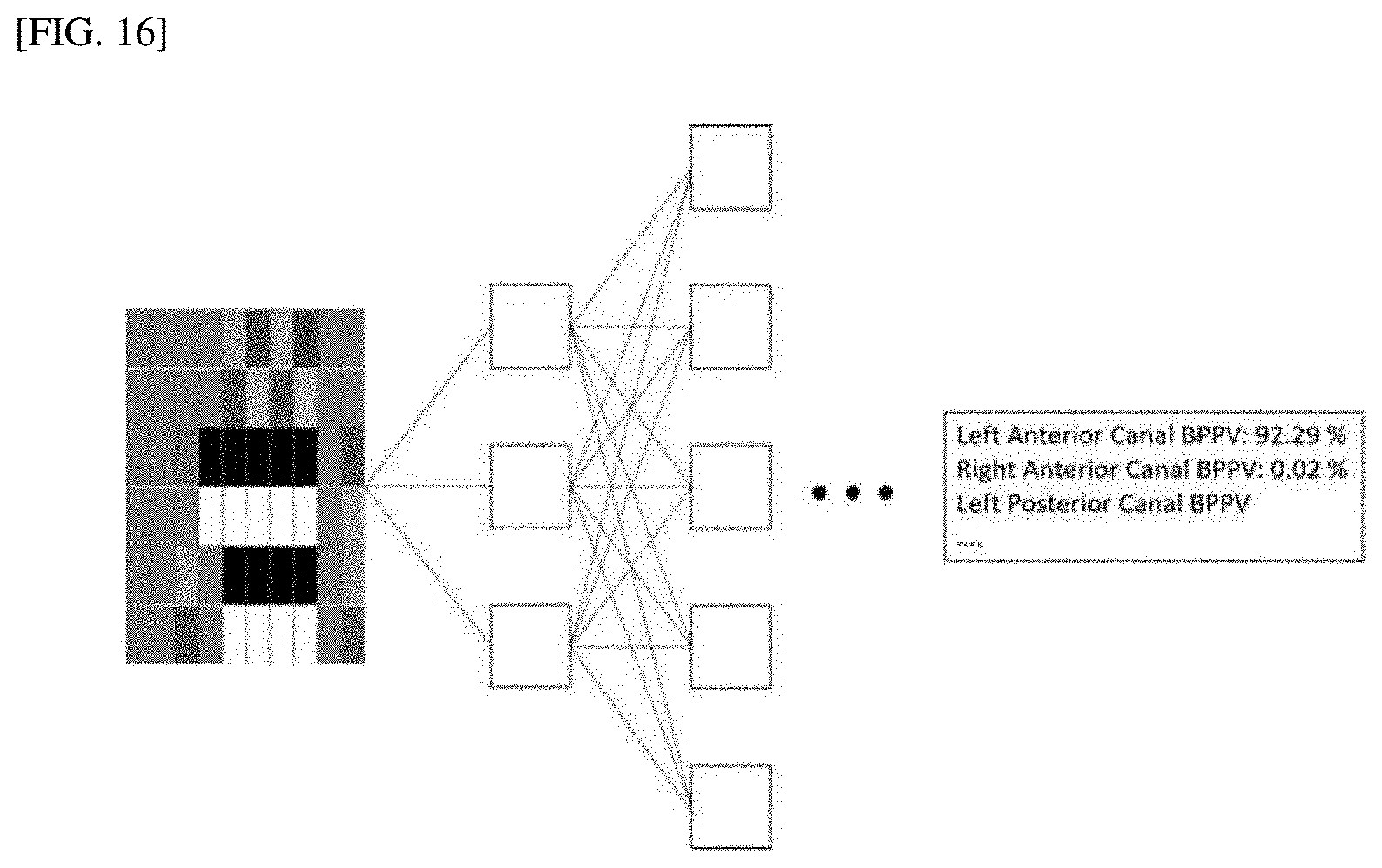 Patent US11779257 Figure 8 – 3-dimensional measurement method for eye movement and fully automated deep-learning based system for vertigo diagnosis