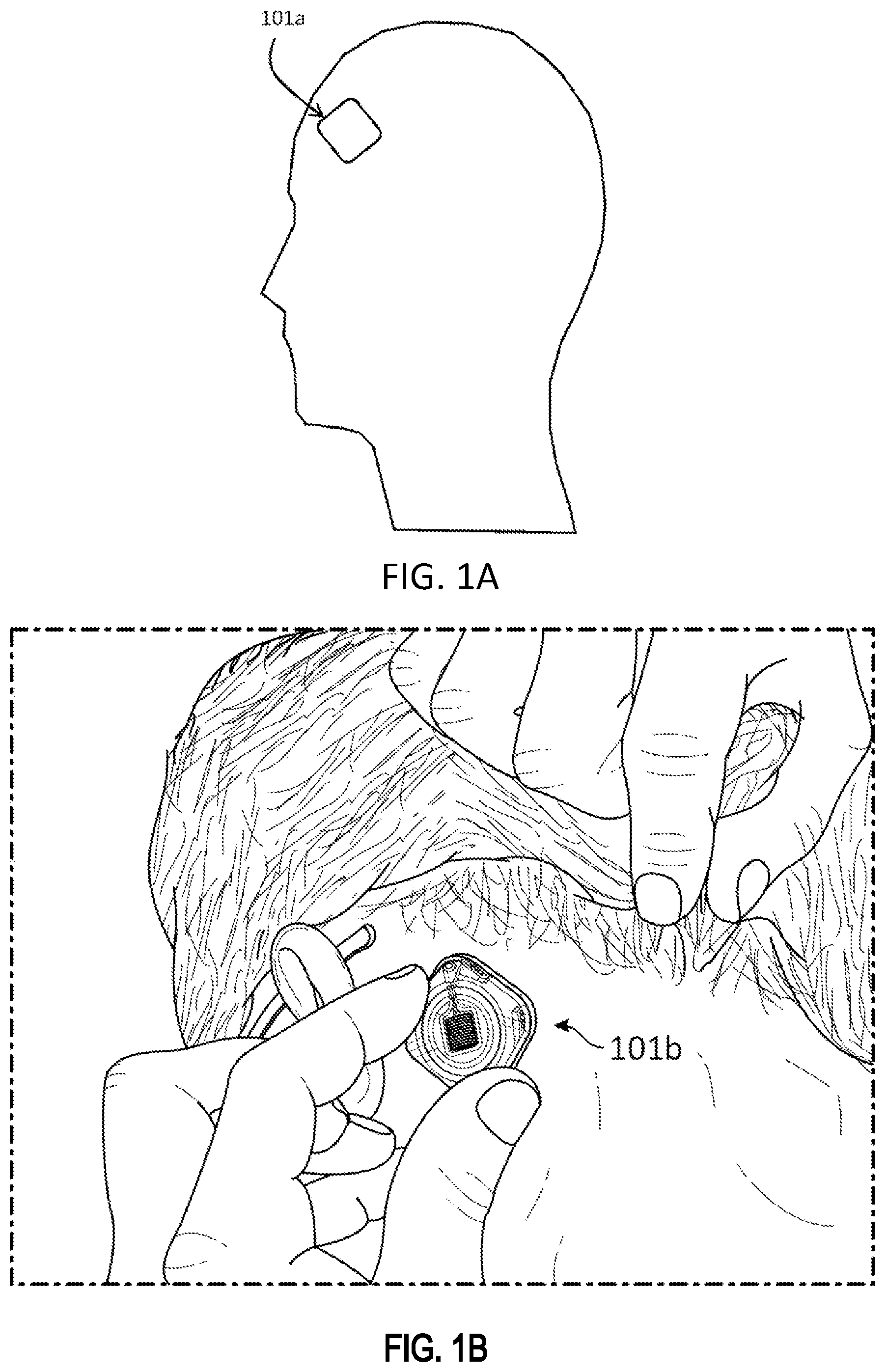 Patent US11779262 Figure 1 – EEG recording and analysis