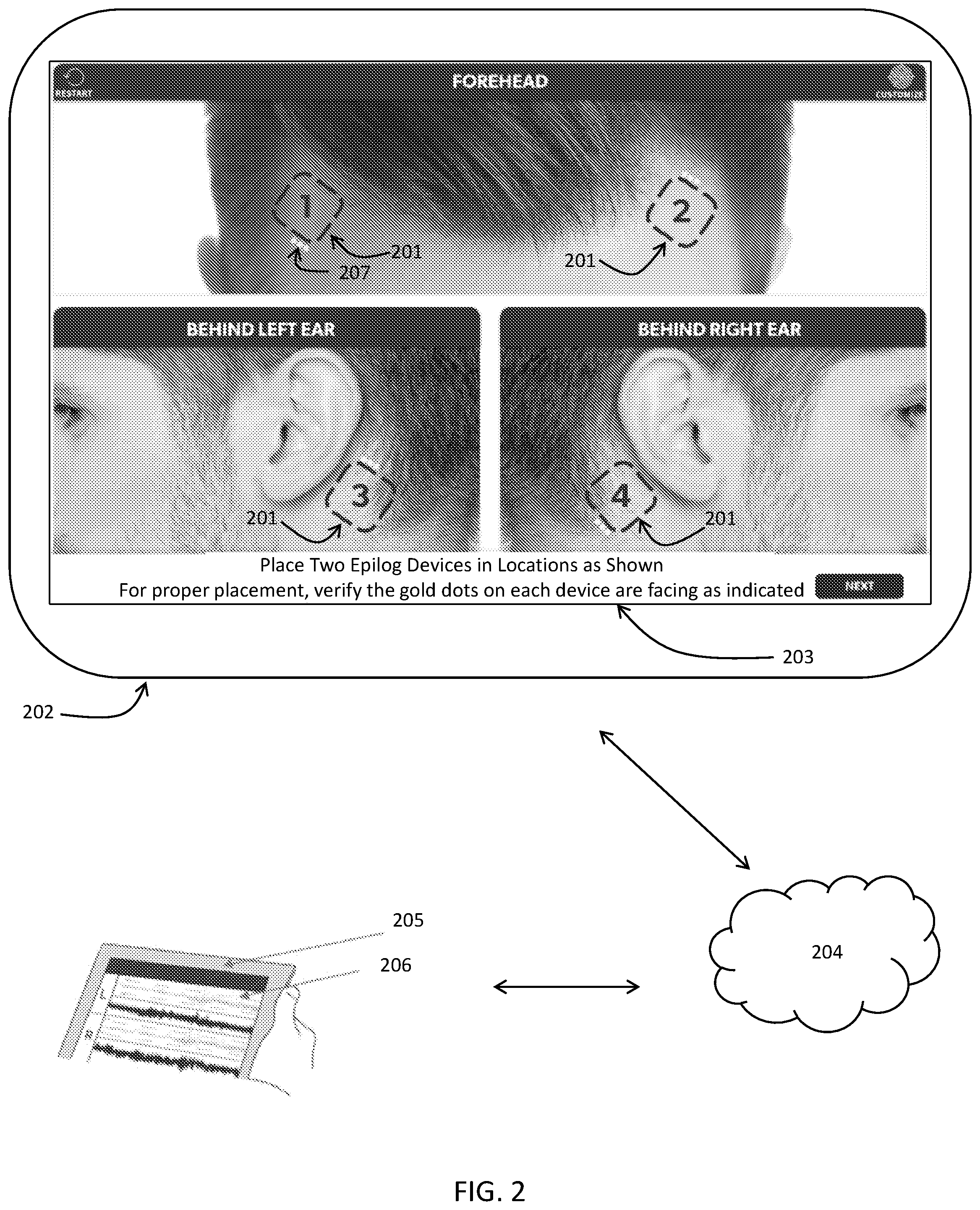 Patent US11779262 Figure 2 – EEG recording and analysis