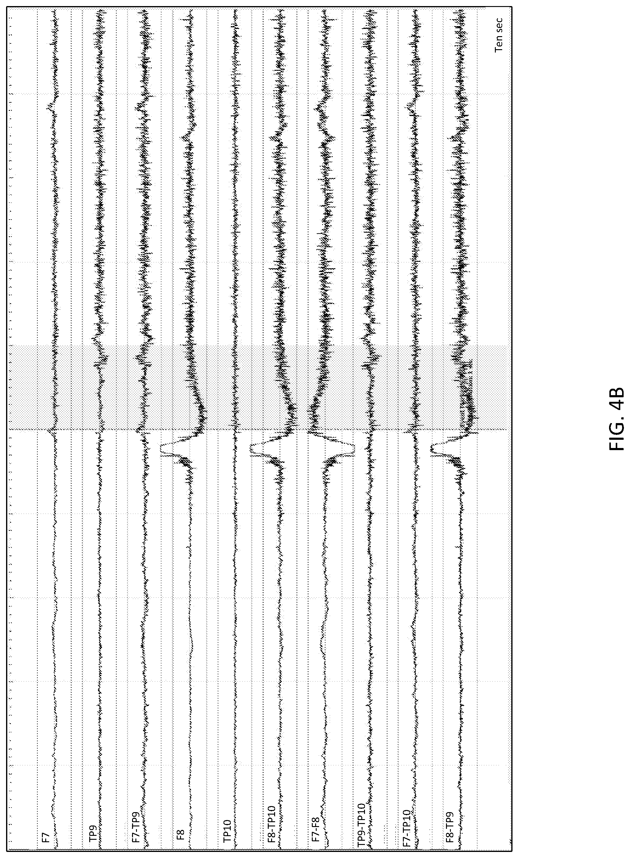 Patent US11779262 Figure 4 – EEG recording and analysis