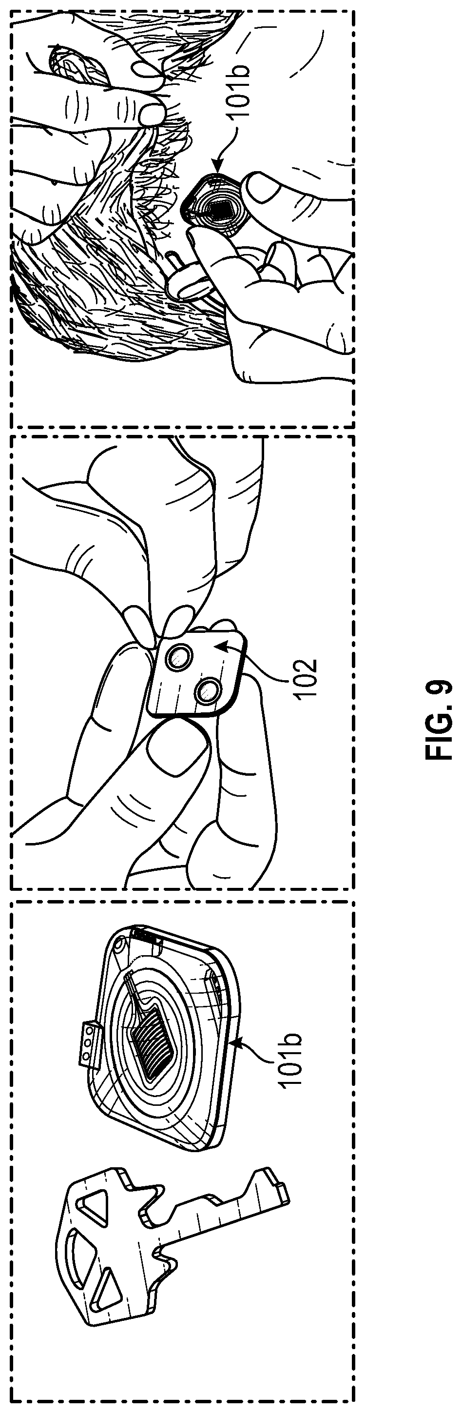 Patent US11779262 Figure 9 – EEG recording and analysis