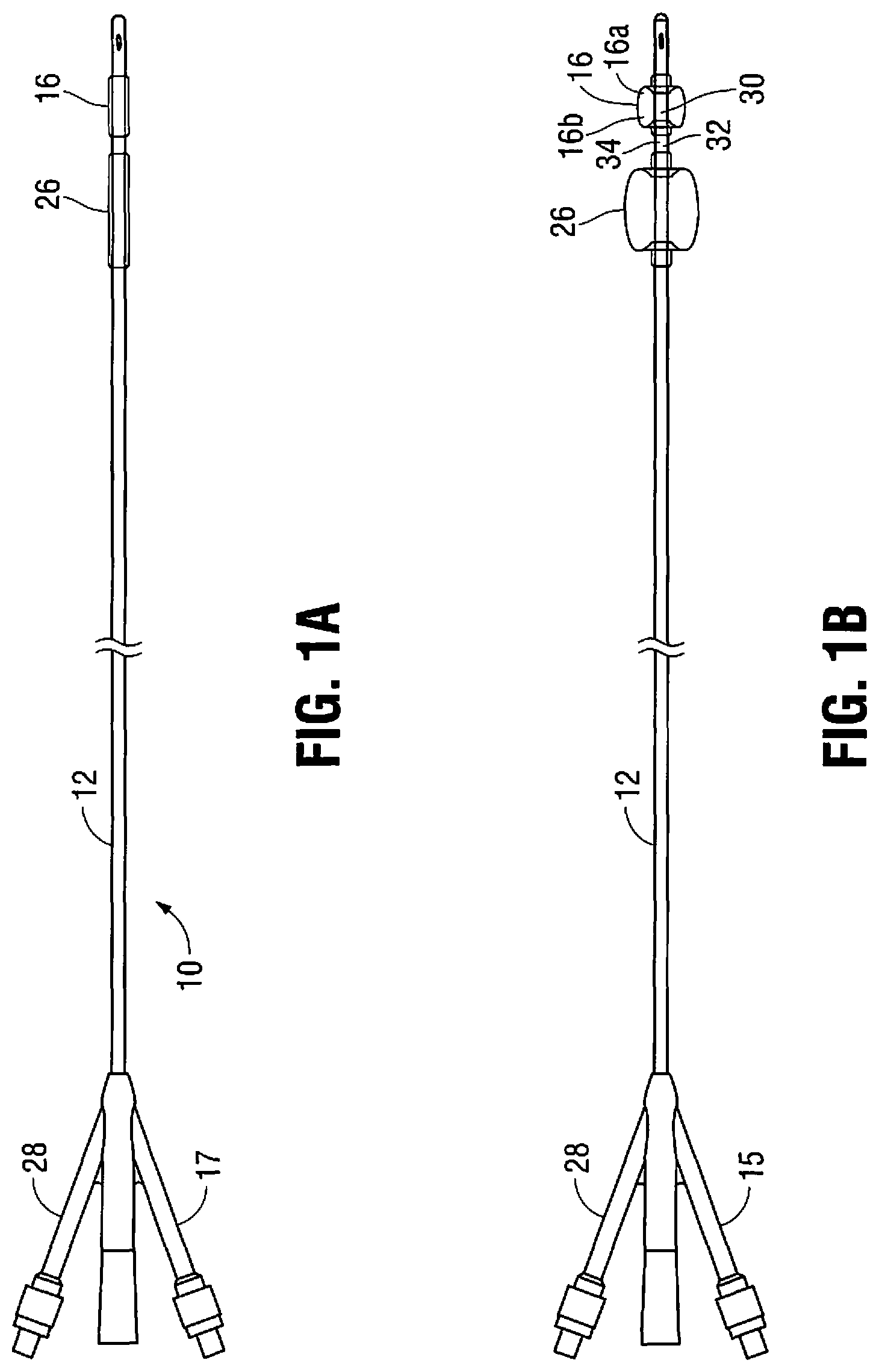 Patent US11779263 Figure 1 – Catheter for monitoring intra-abdominal pressure for assessing preeclampsia