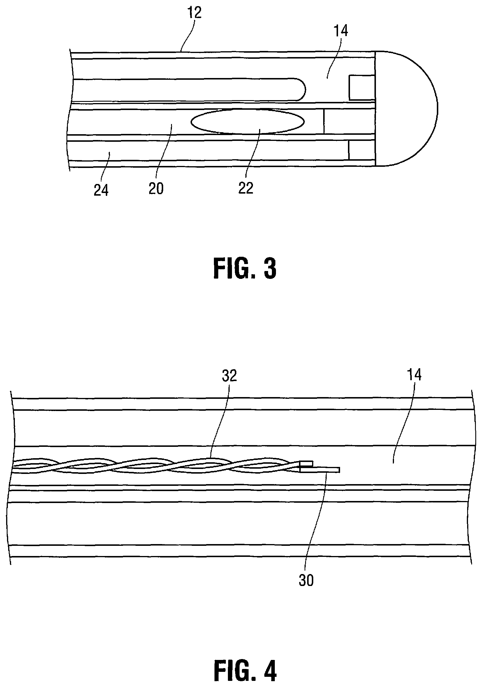 Patent US11779263 Figure 3 – Catheter for monitoring intra-abdominal pressure for assessing preeclampsia