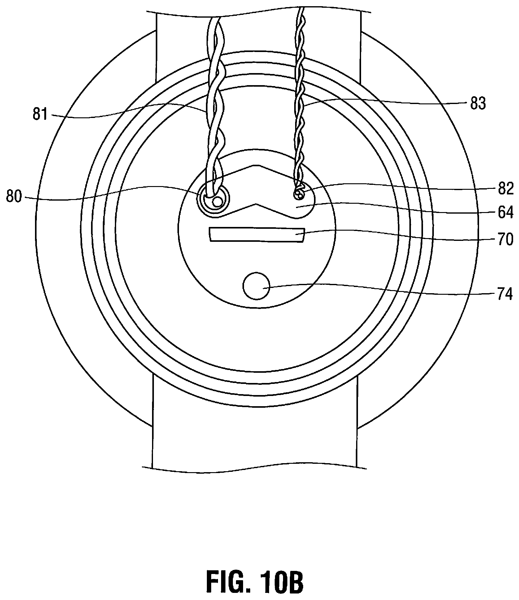 Patent US11779263 Figure 7 – Catheter for monitoring intra-abdominal pressure for assessing preeclampsia